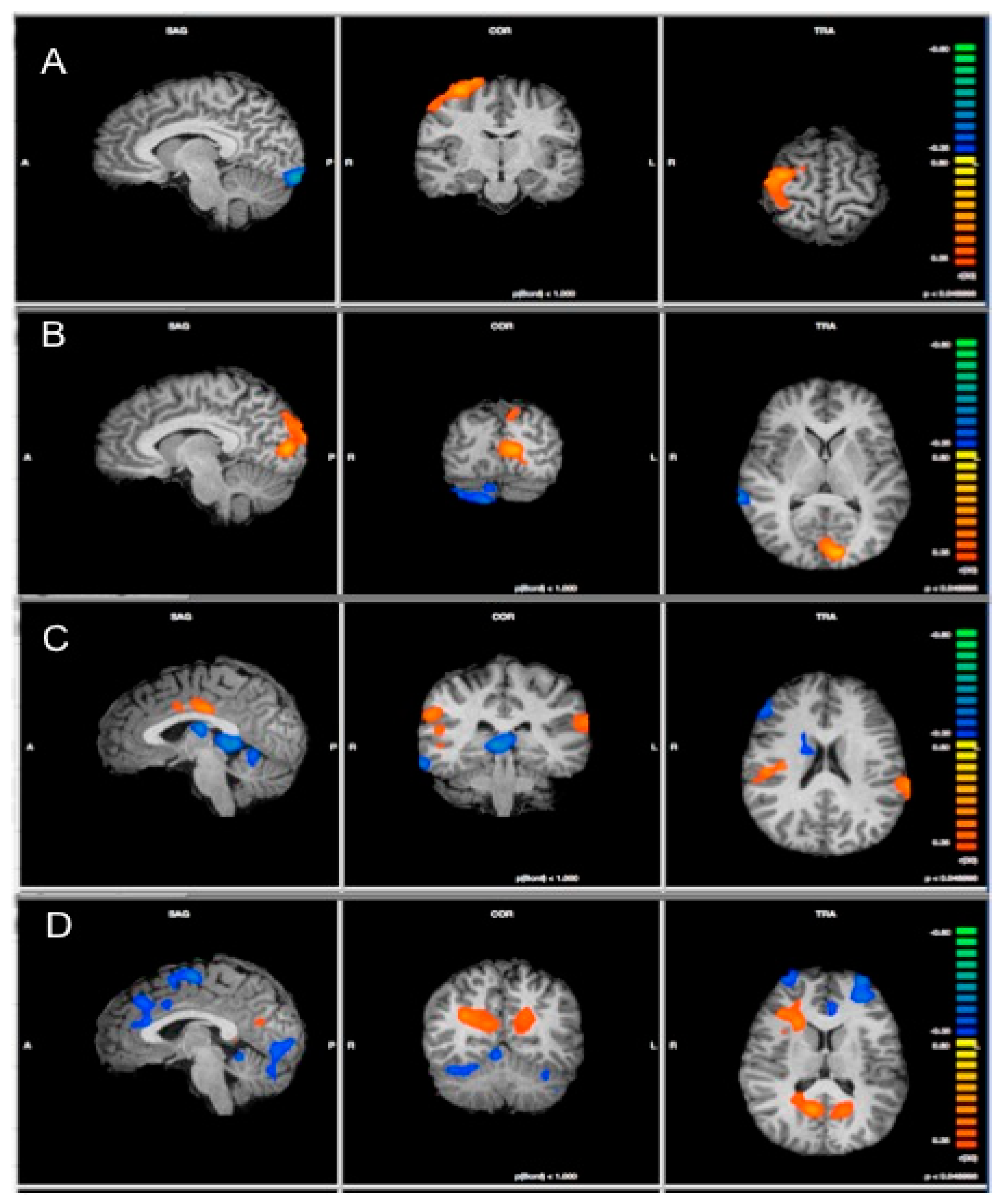 Brainsci 08 00128 g001