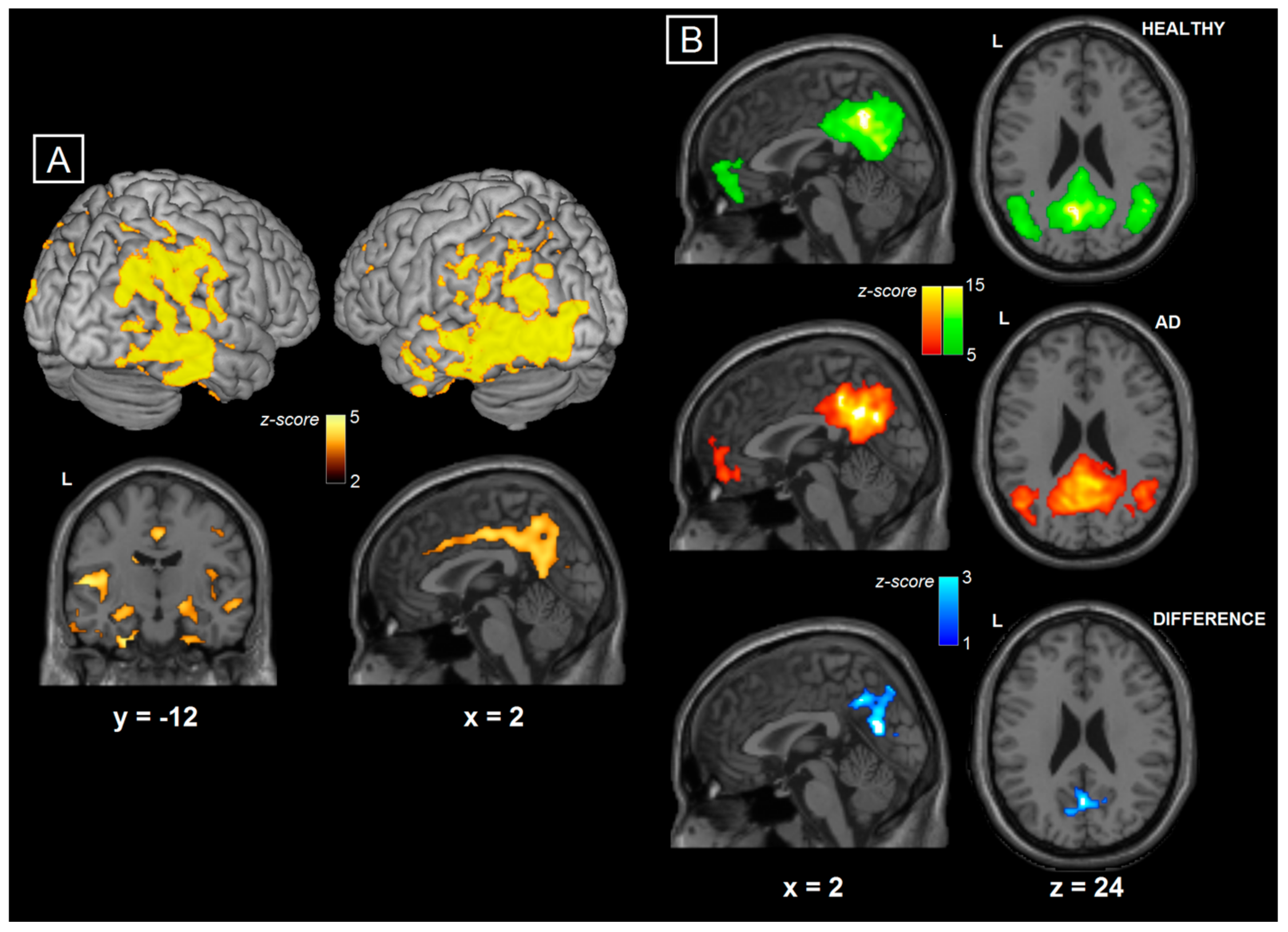 Brainsci 08 00134 g002