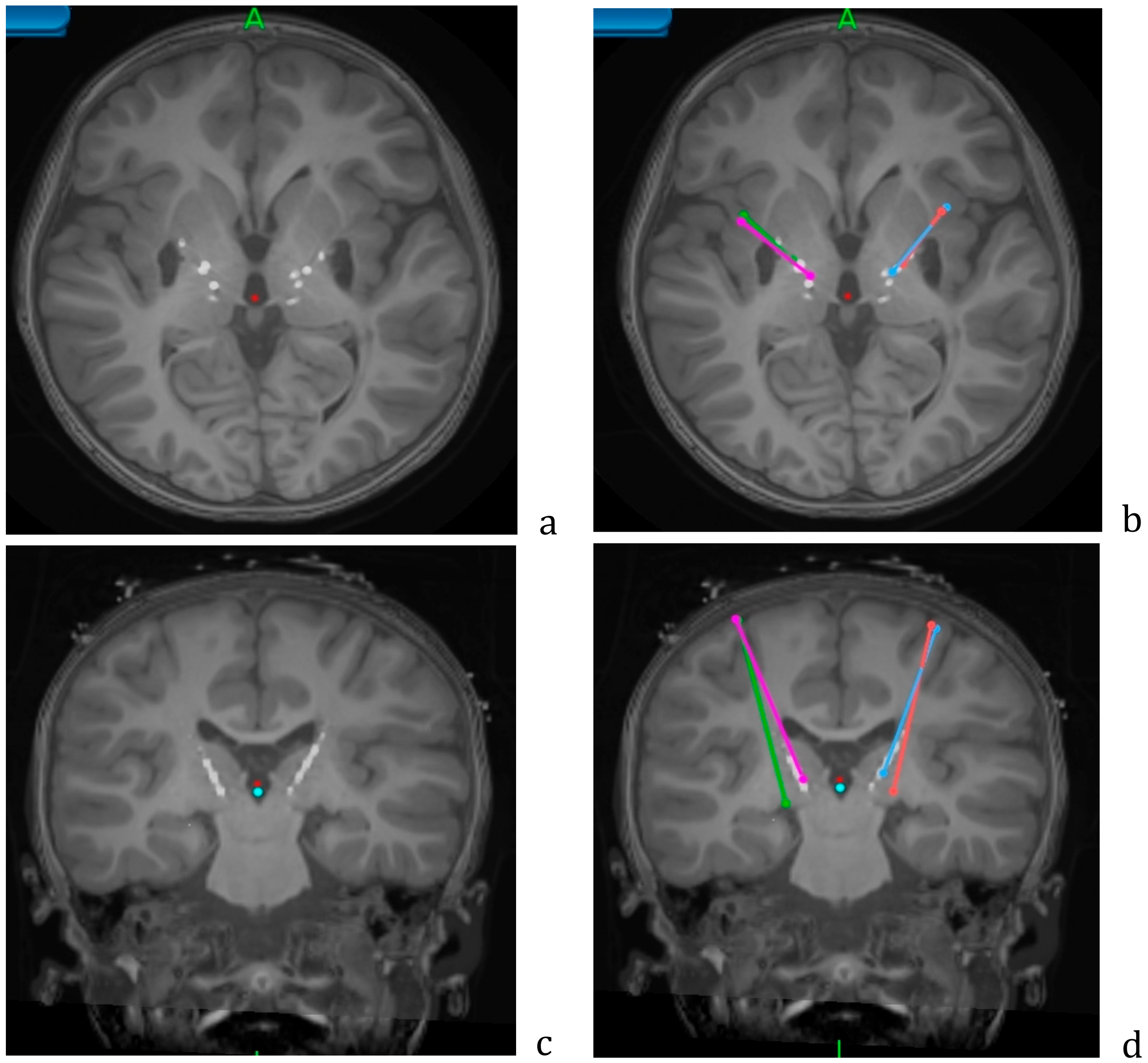 Brainsci 08 00135 g004 Brainsci 08 00135 g004