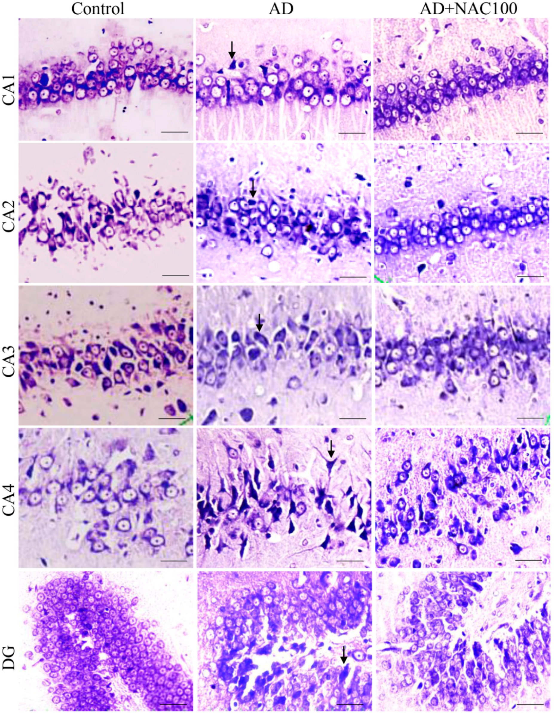 Brainsci 08 00185 g003 Brainsci 08 00185 g003