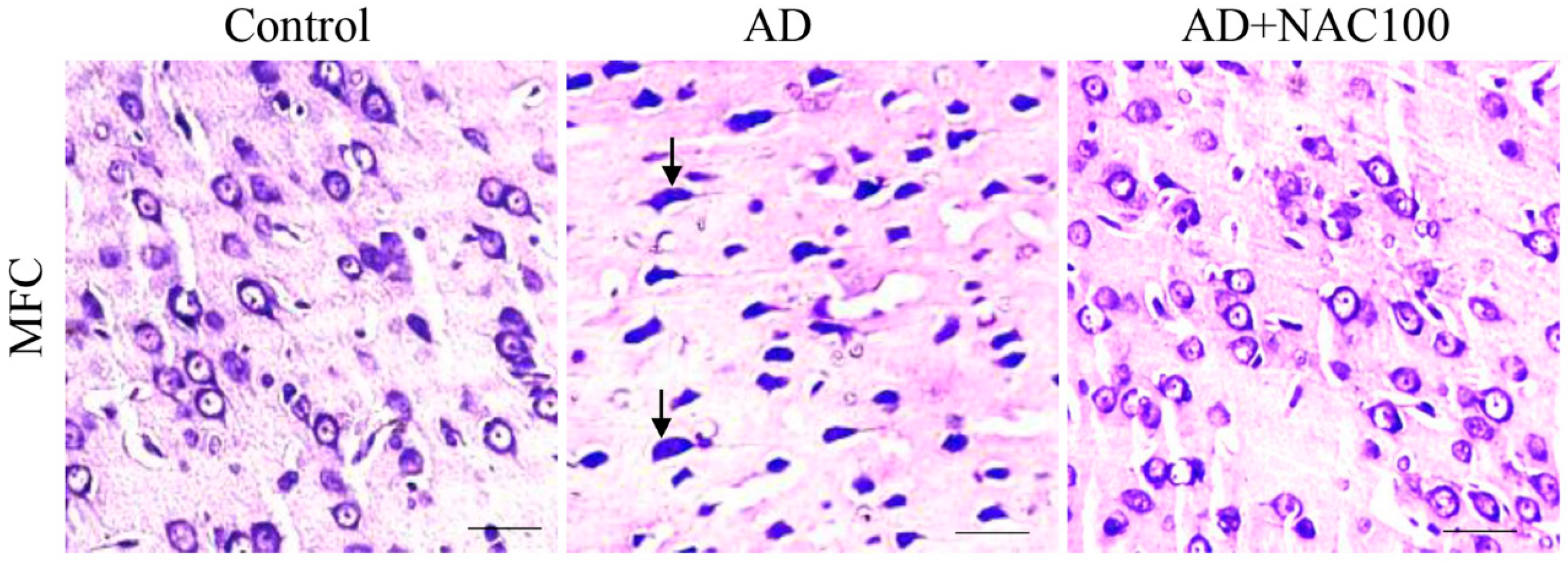 Brainsci 08 00185 g005 Brainsci 08 00185 g005