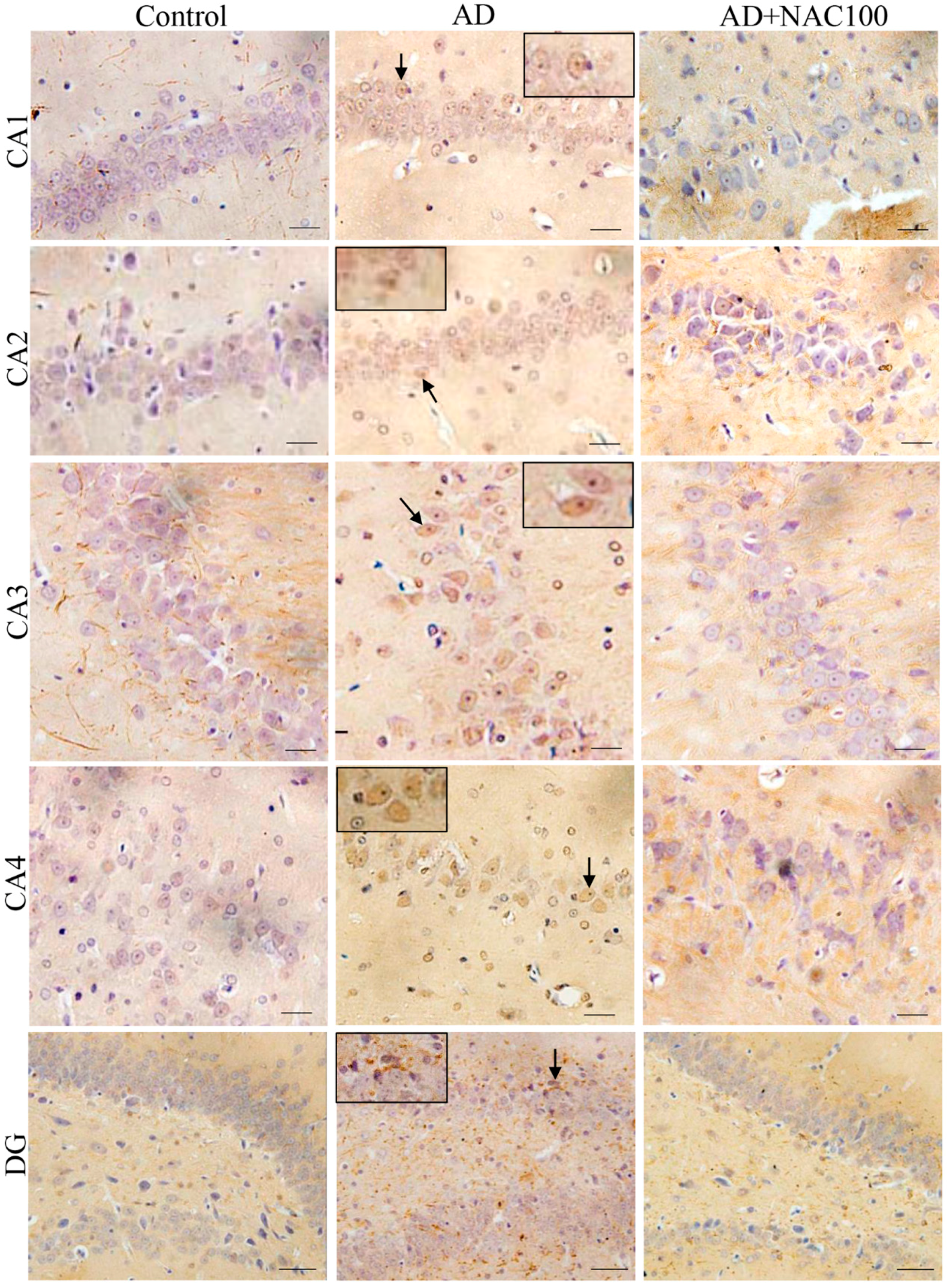Brainsci 08 00185 g007 Brainsci 08 00185 g007