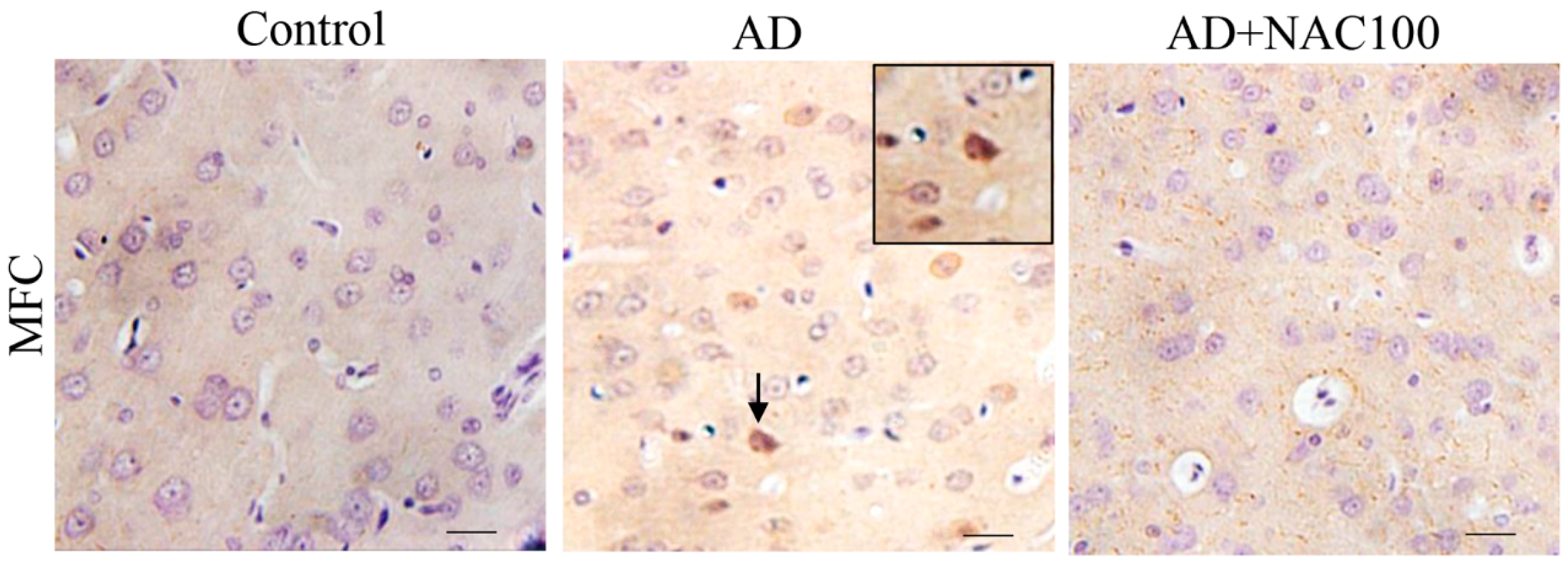 Brainsci 08 00185 g008 Brainsci 08 00185 g008