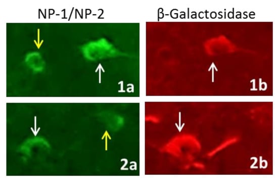 Brainsci 08 00196 g0a1