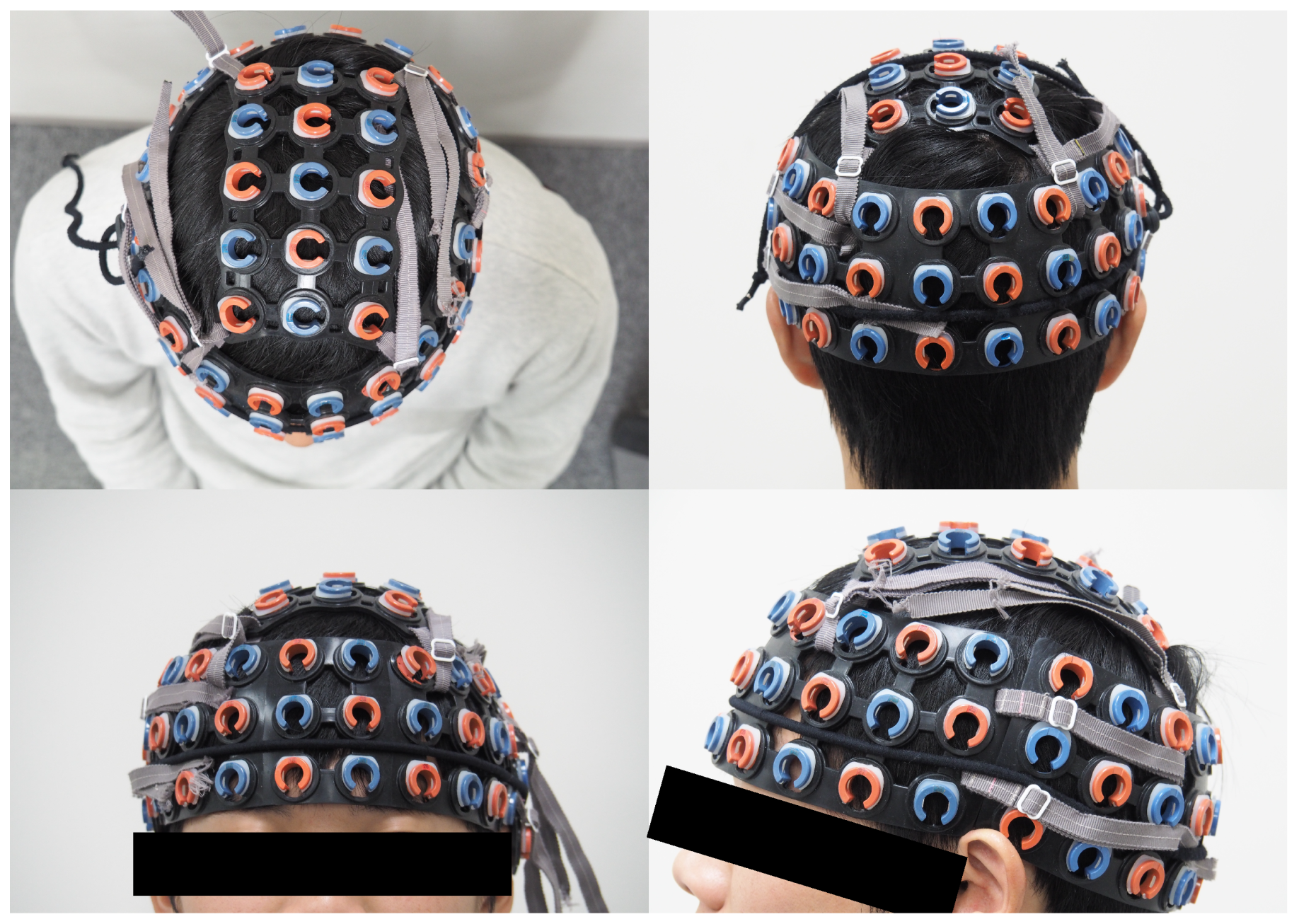 Brainsci 09 00043 g002