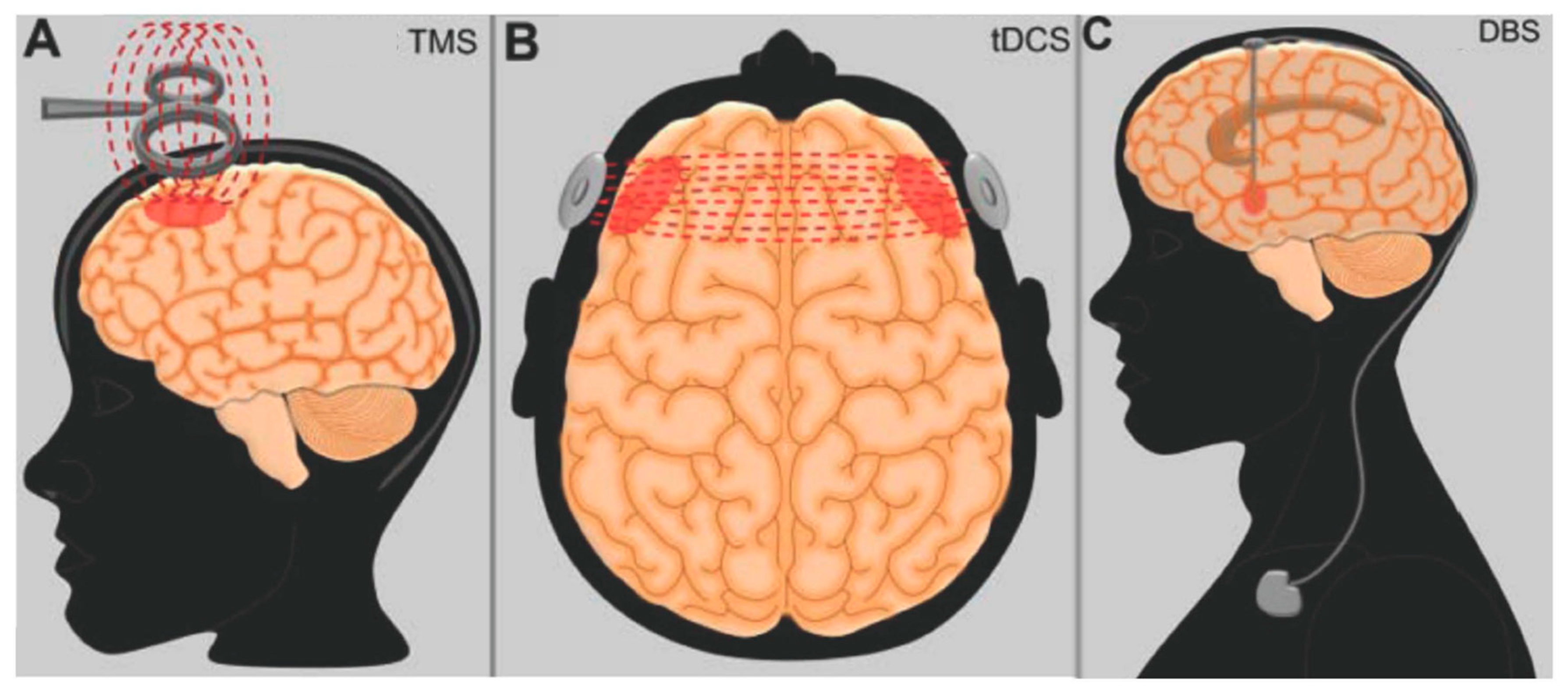 Brainsci 09 00045 g002