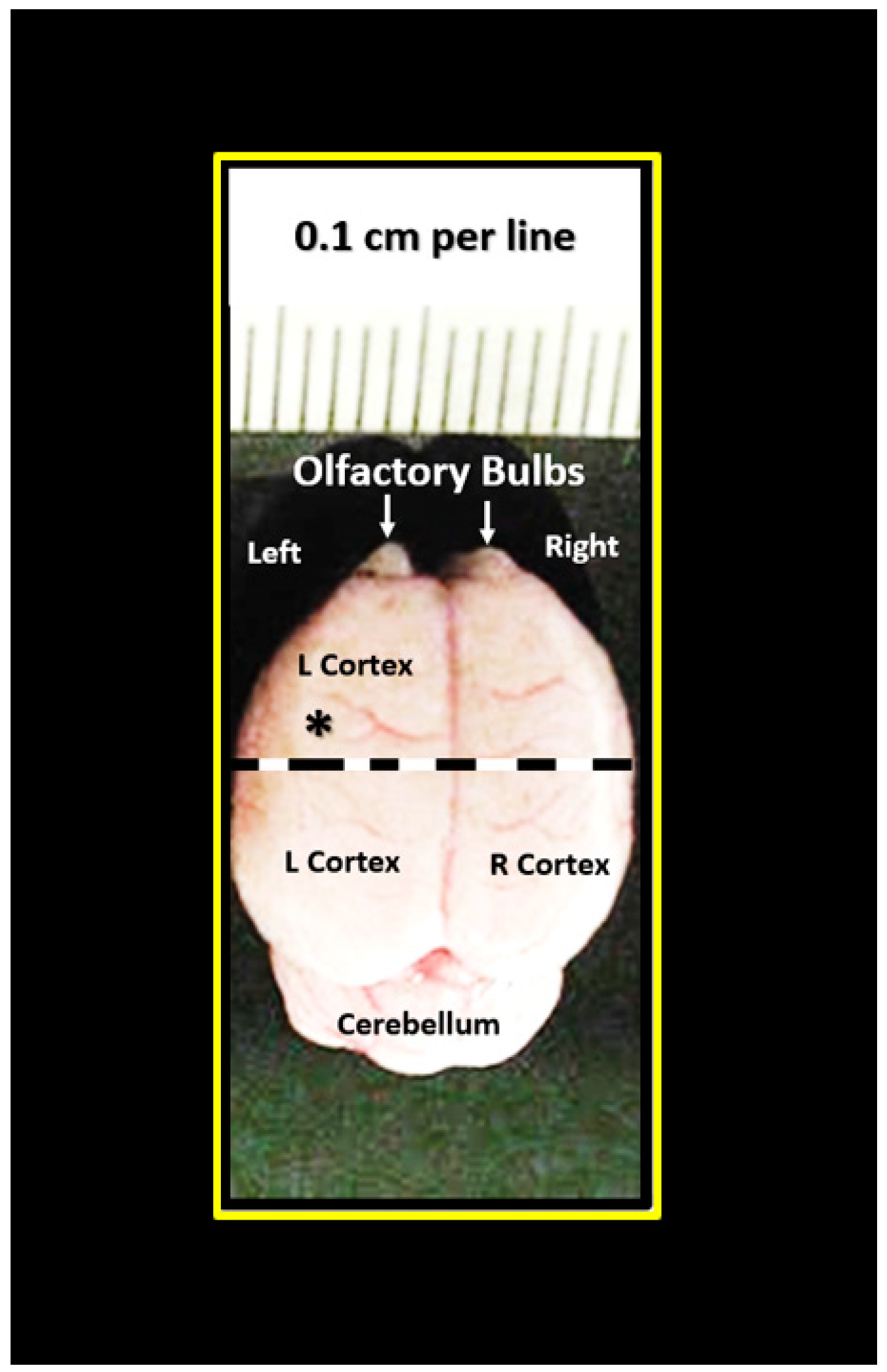 Brainsci 09 00057 g002