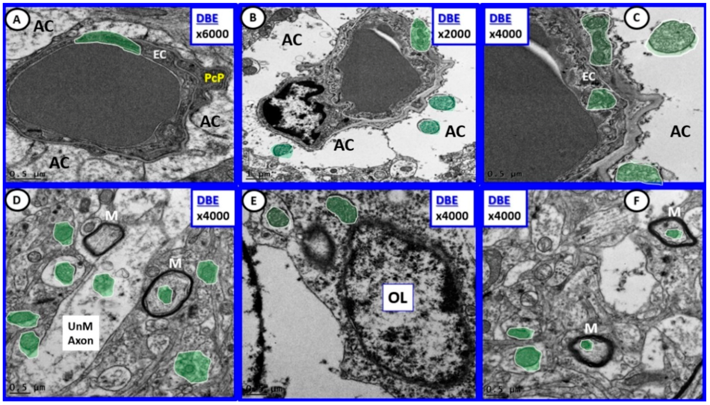 Brainsci 09 00057 g006