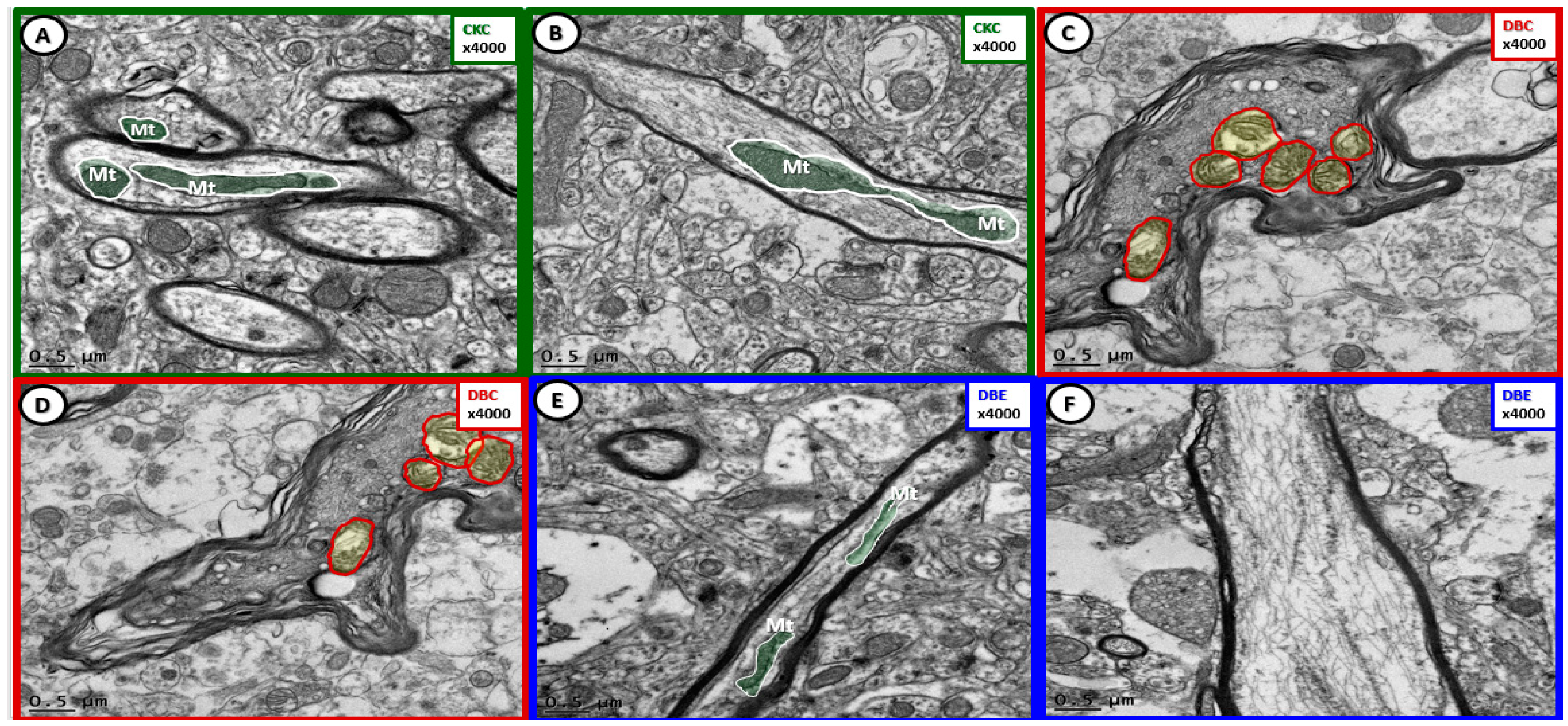 Brainsci 09 00057 g007