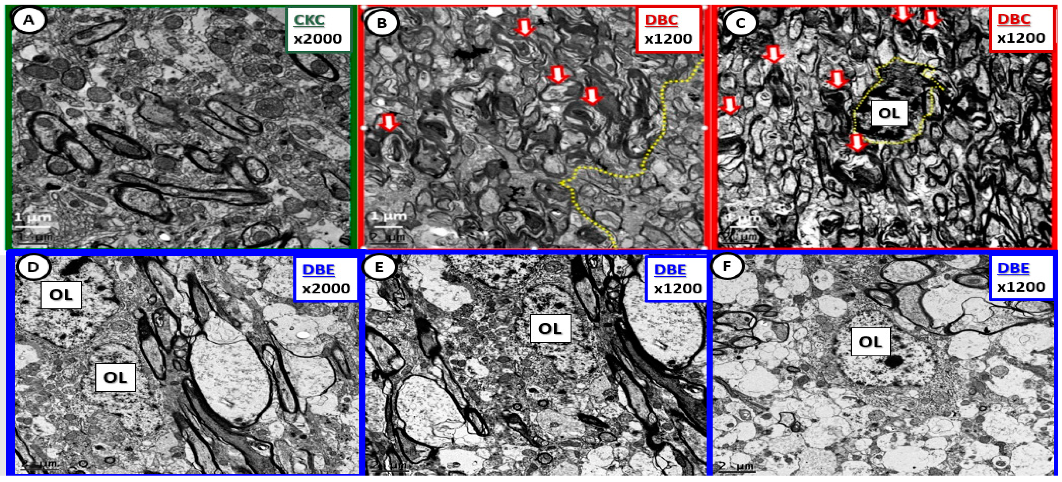 Brainsci 09 00057 g008