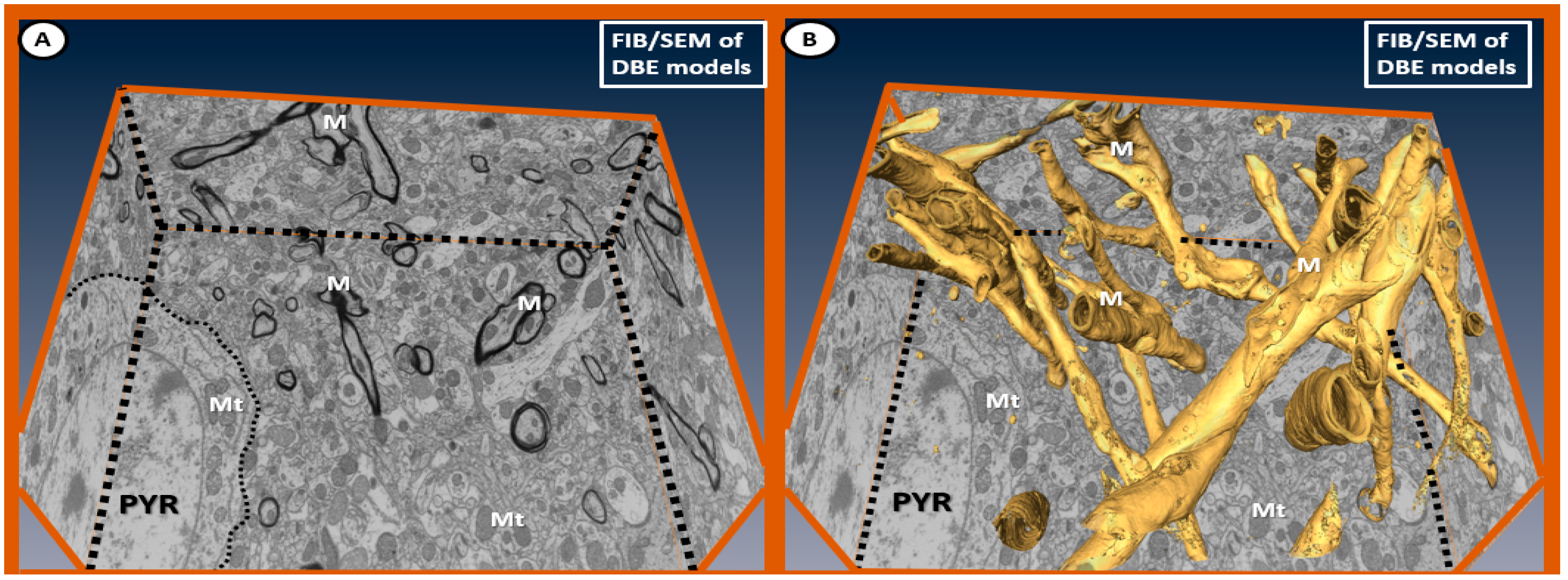 Brainsci 09 00057 g011