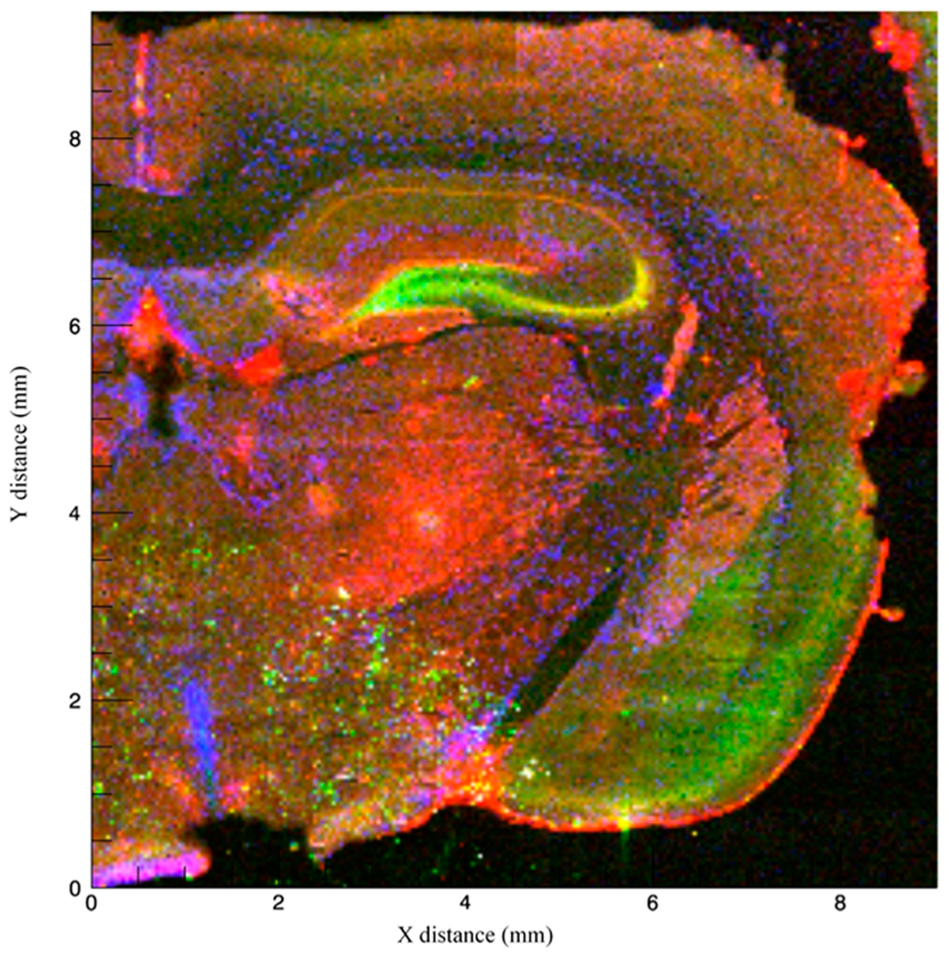 Brainsci 09 00074 g002 Brainsci 09 00074 g002