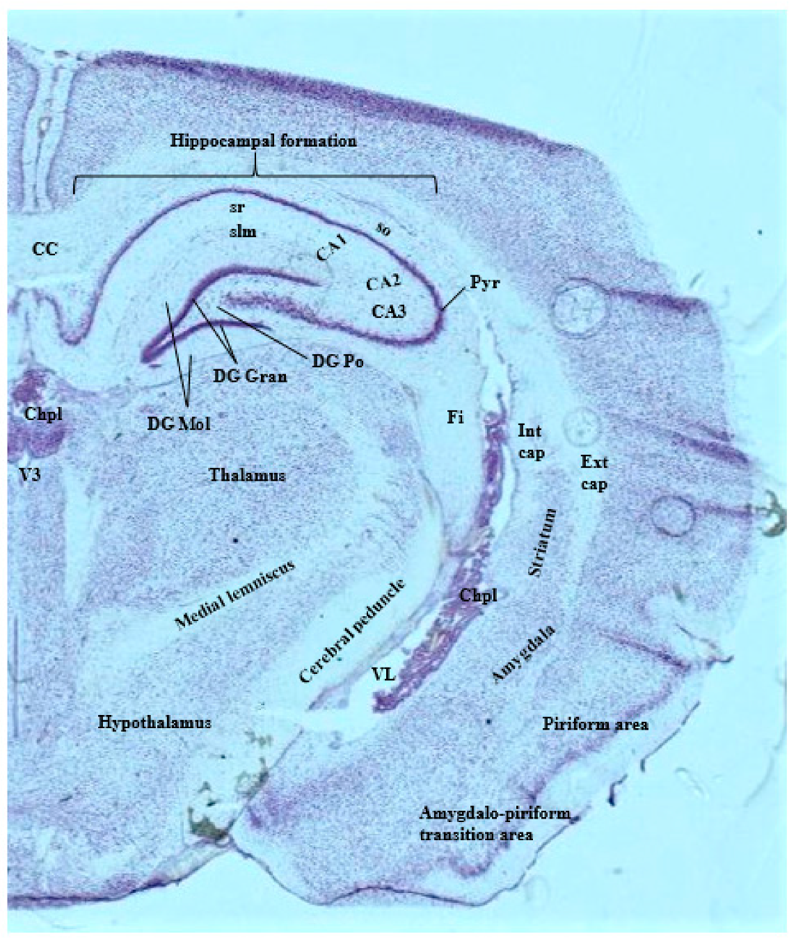 Brainsci 09 00074 g003 Brainsci 09 00074 g003