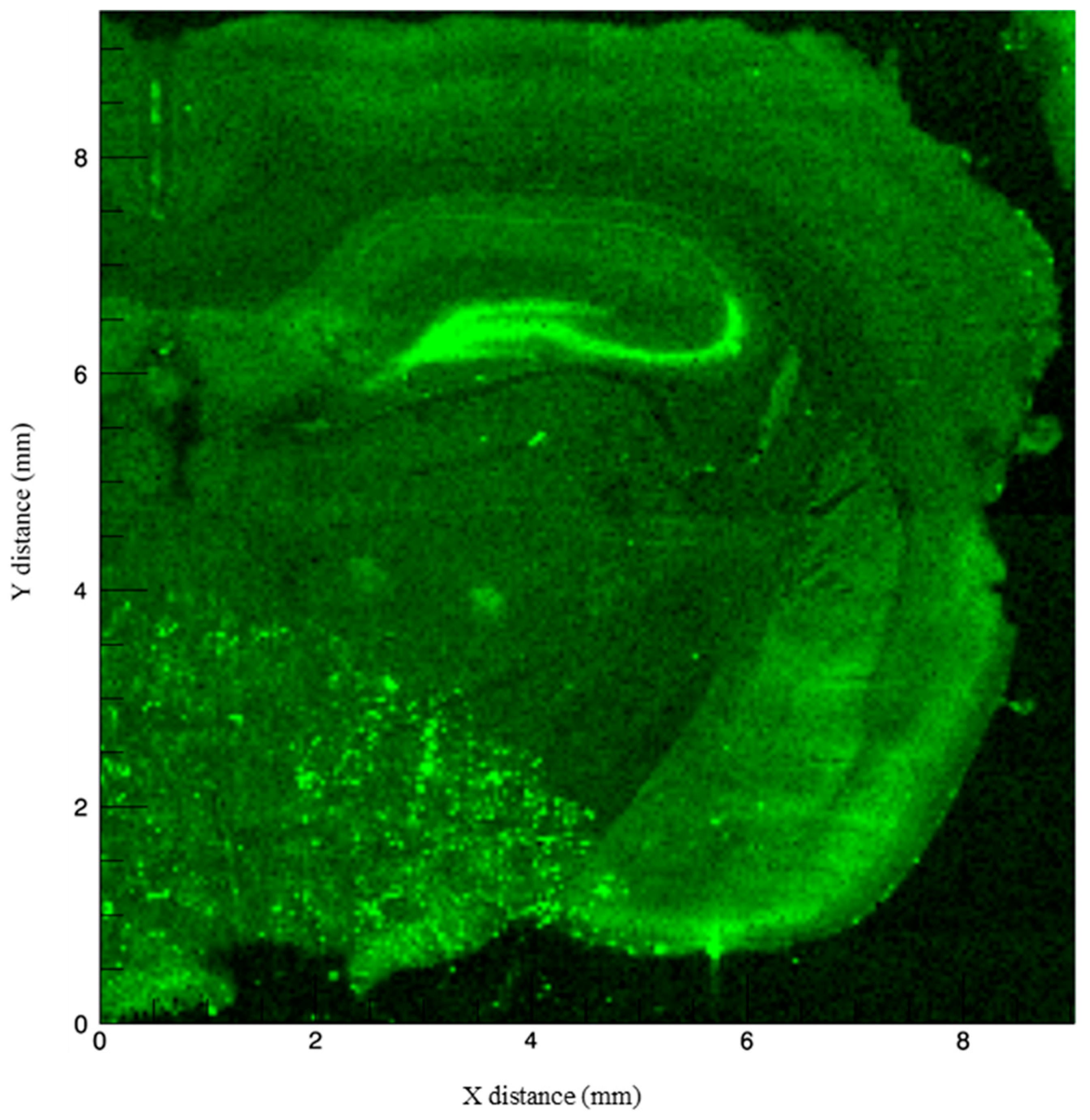 Brainsci 09 00074 g004 Brainsci 09 00074 g004