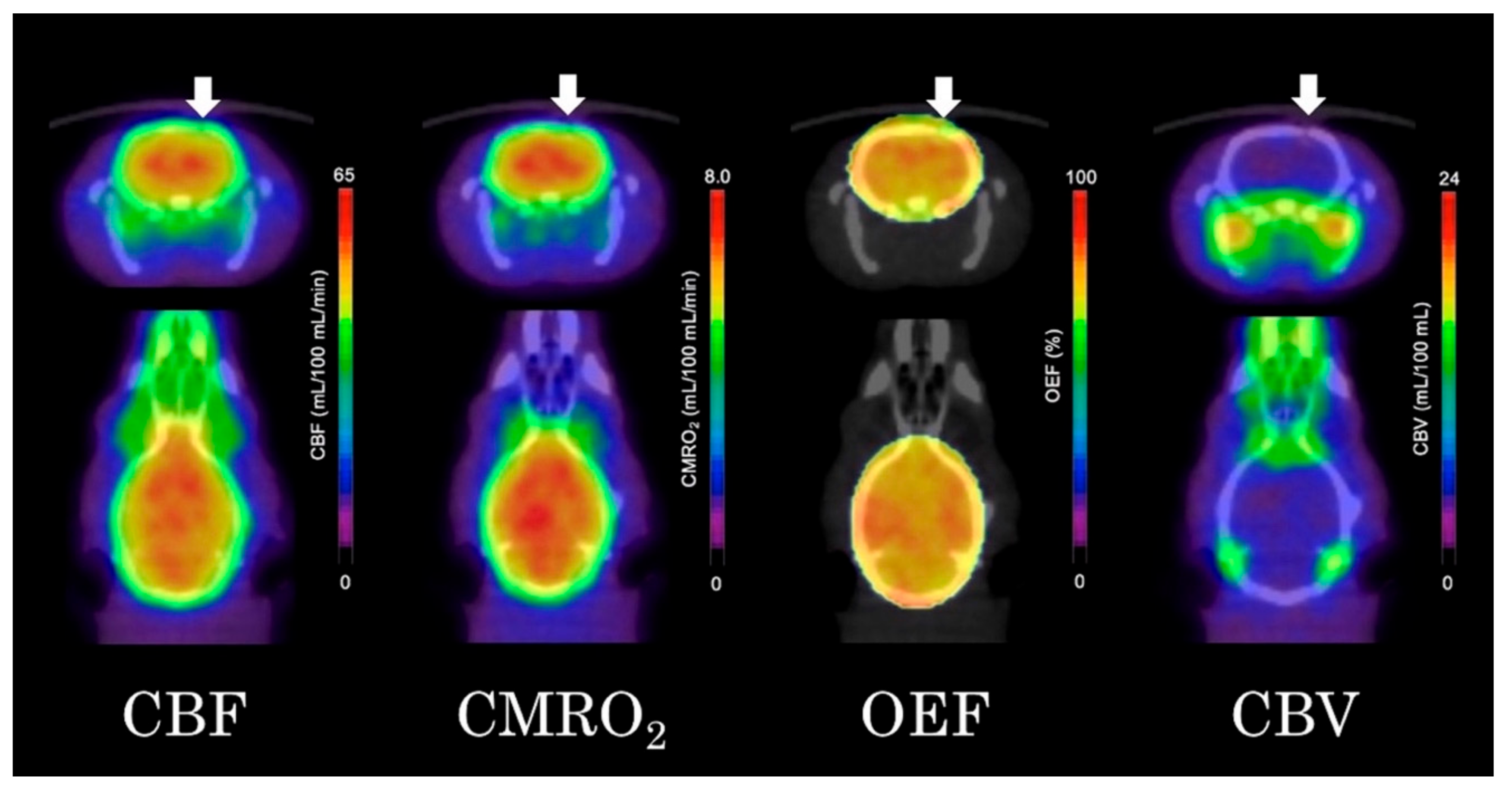 Brainsci 09 00101 g004 Brainsci 09 00101 g004