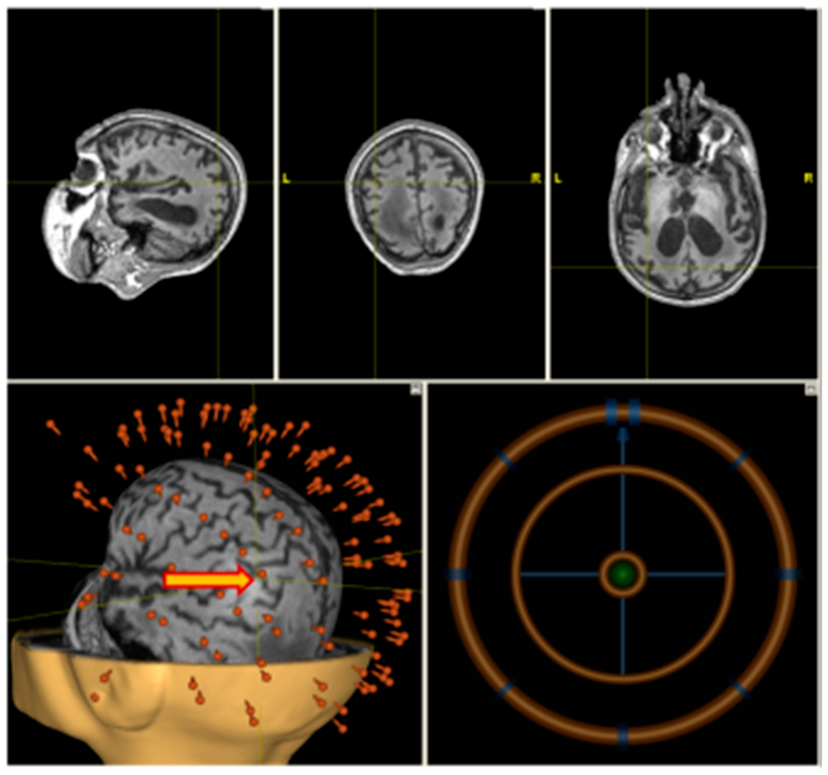 Brainsci 09 00103 g002 Brainsci 09 00103 g002
