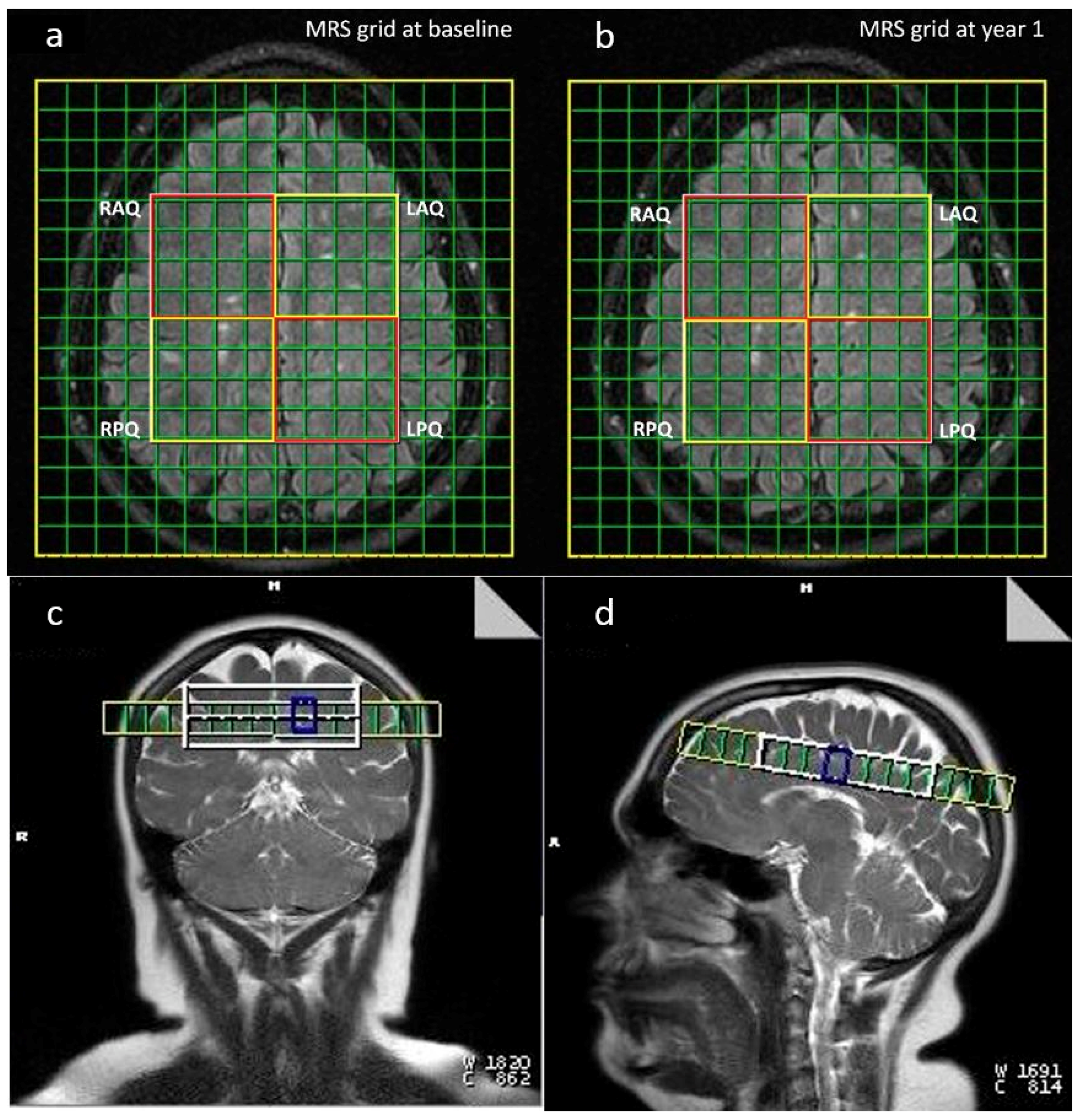 Brainsci 09 00122 g001