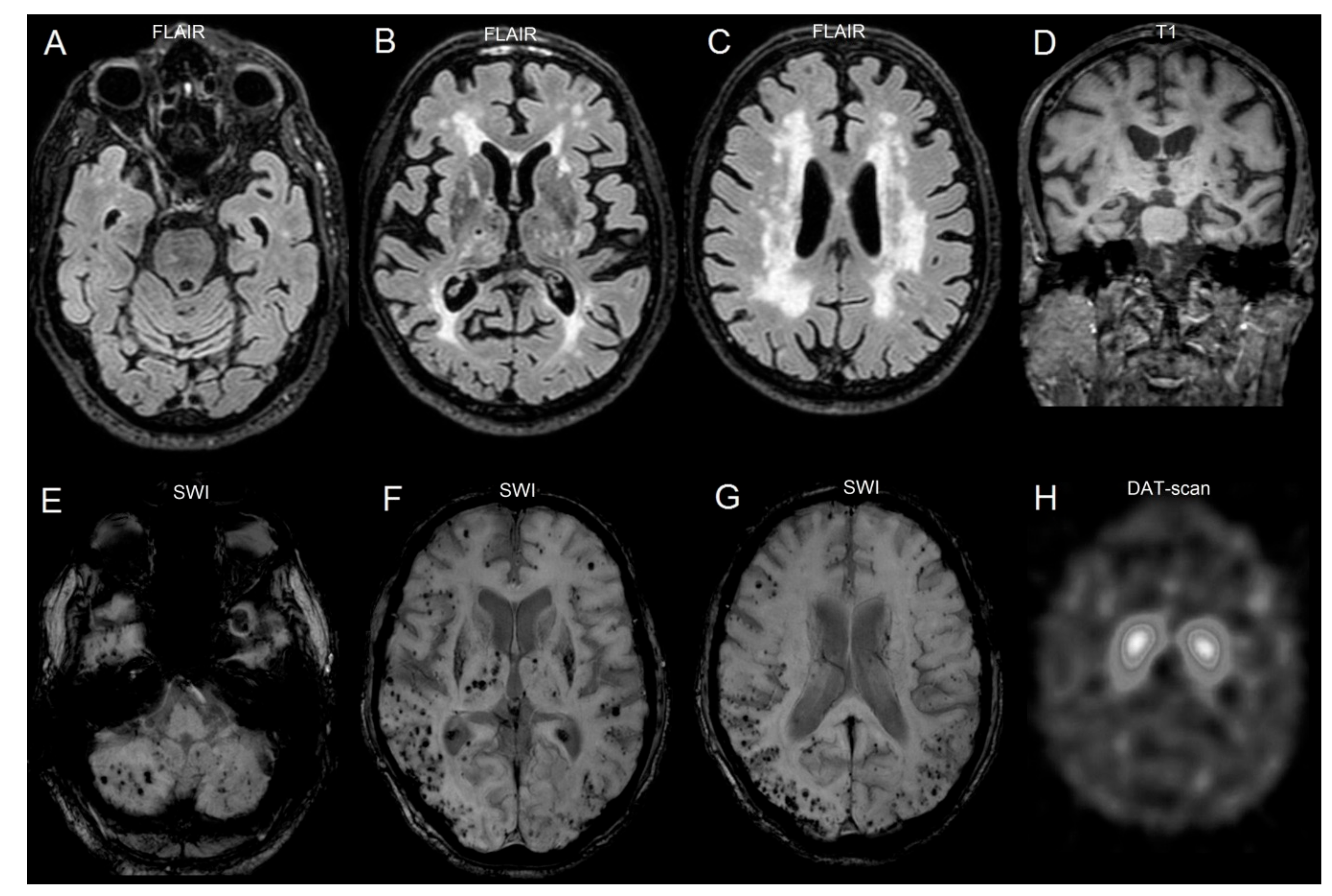 Brainsci 09 00159 g001 Brainsci 09 00159 g001