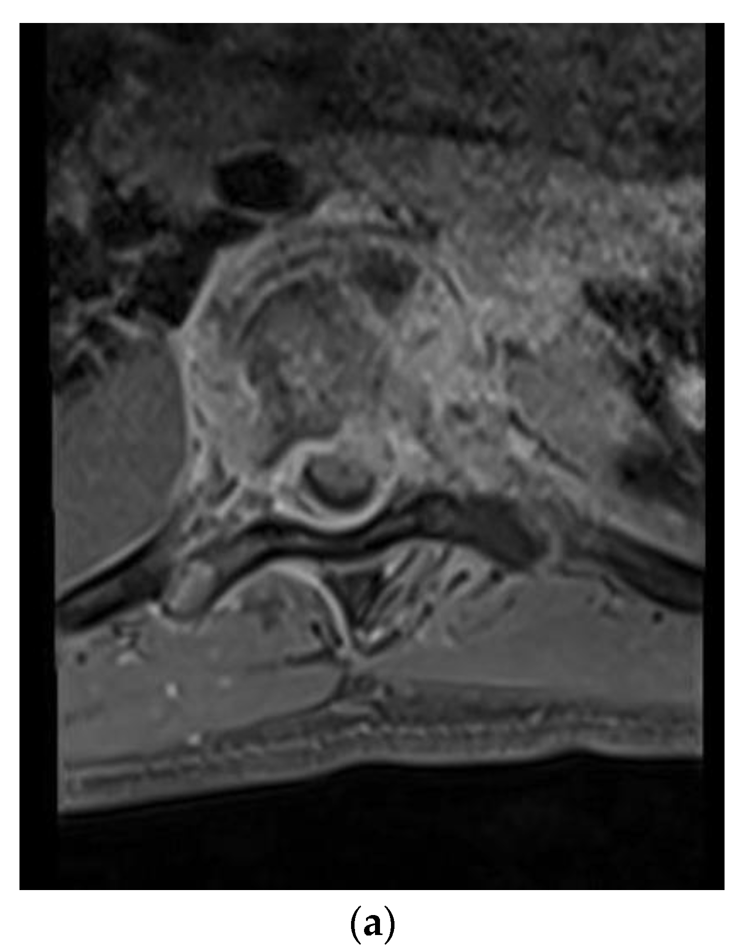 Brainsci 09 00160 g001a