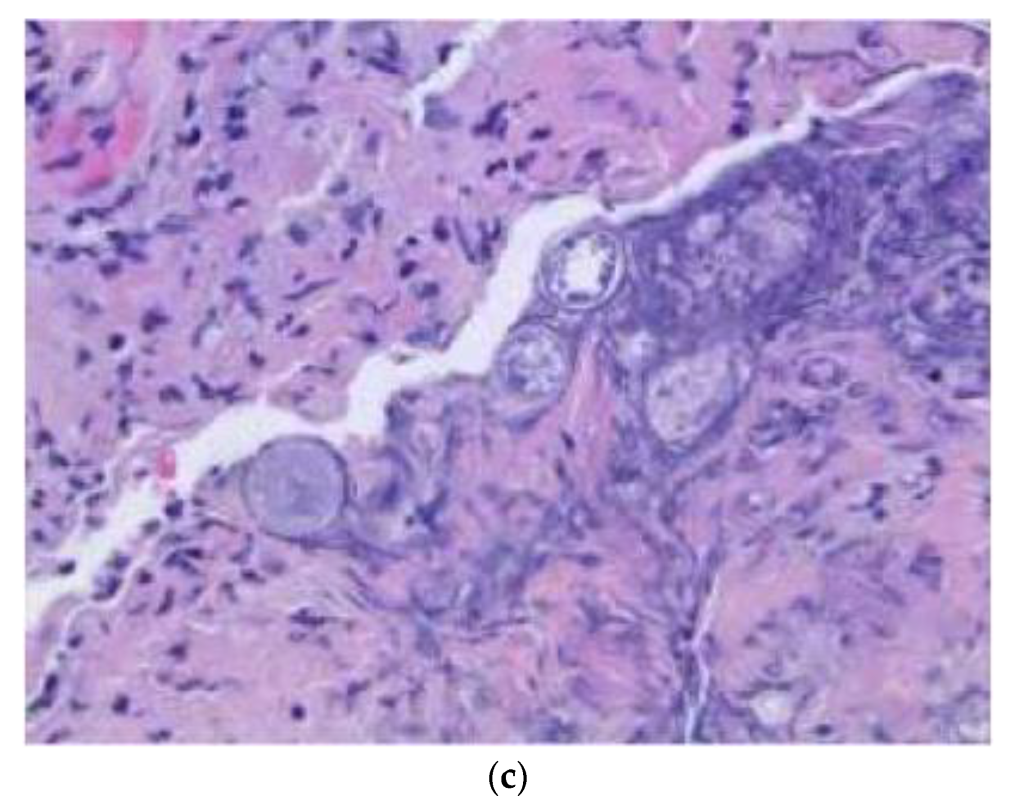 Brainsci 09 00160 g003b