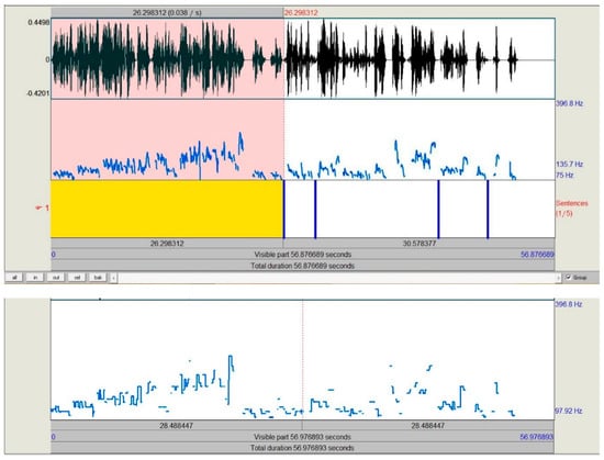 Brainsci 09 00169 g0a3