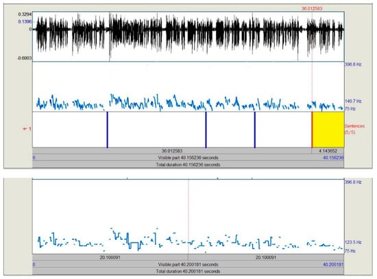 Brainsci 09 00169 g0a5