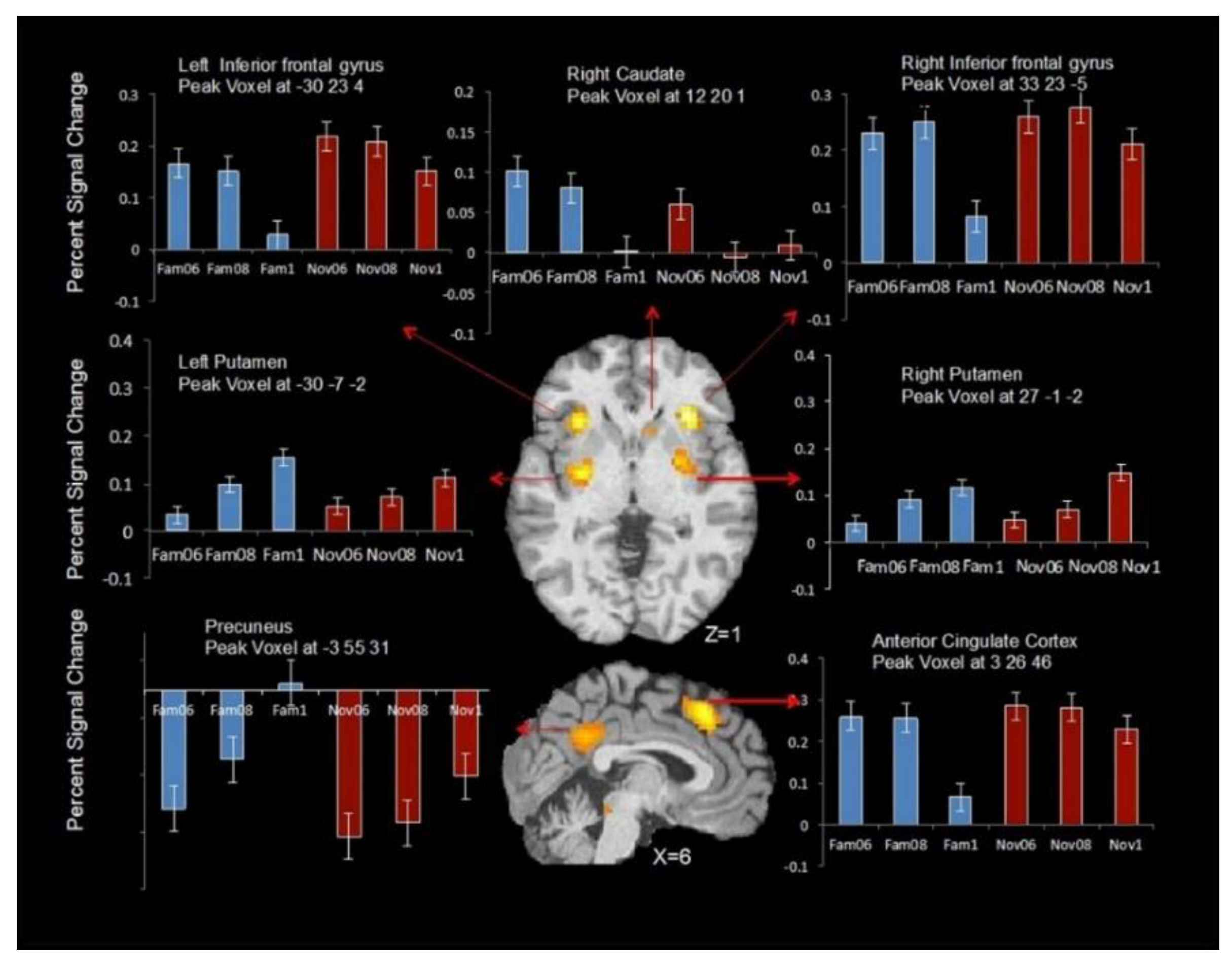 Brainsci 09 00174 g004