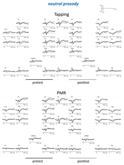 Brainsci 09 00206 g0a1