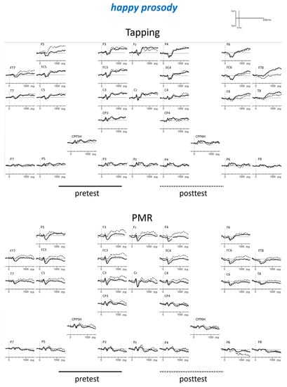 Brainsci 09 00206 g0a2