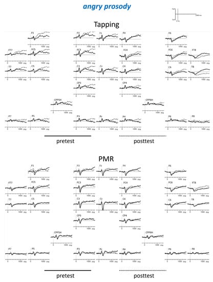 Brainsci 09 00206 g0a3