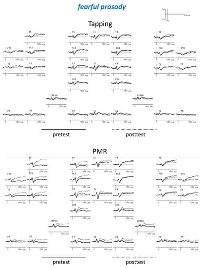 Brainsci 09 00206 g0a4