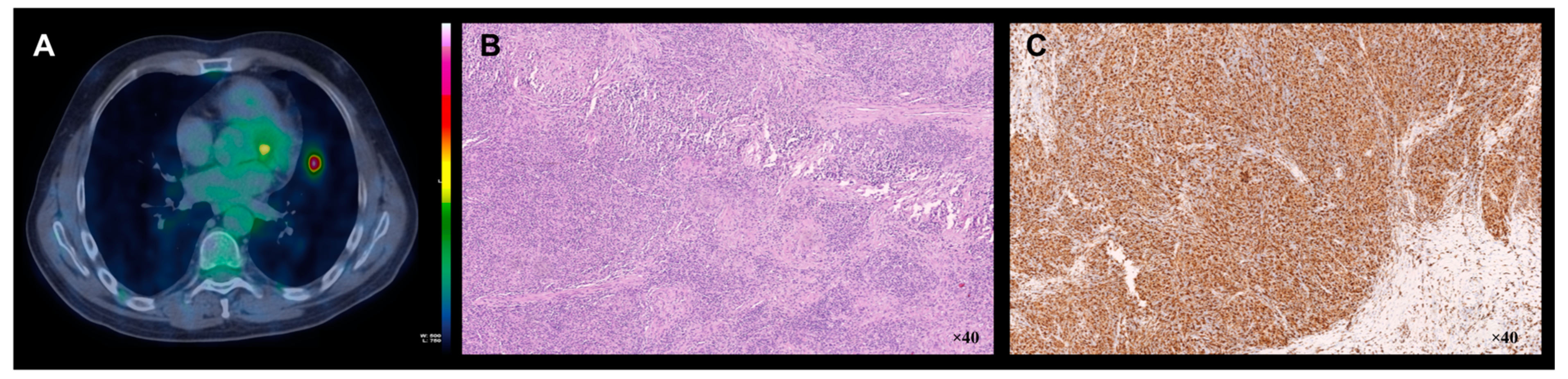 Brainsci 09 00243 g002 Brainsci 09 00243 g002