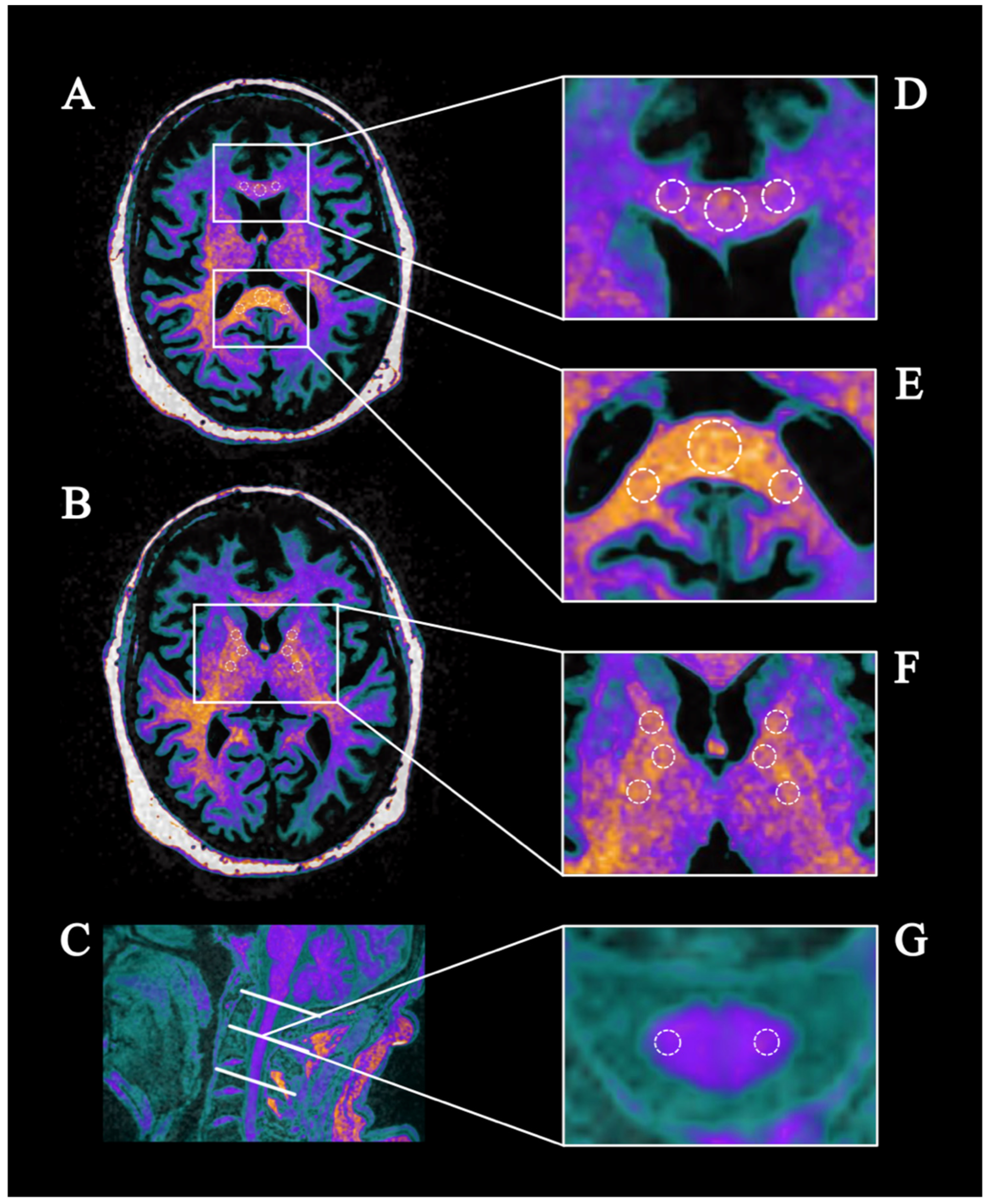 Brainsci 09 00268 g002 Brainsci 09 00268 g002