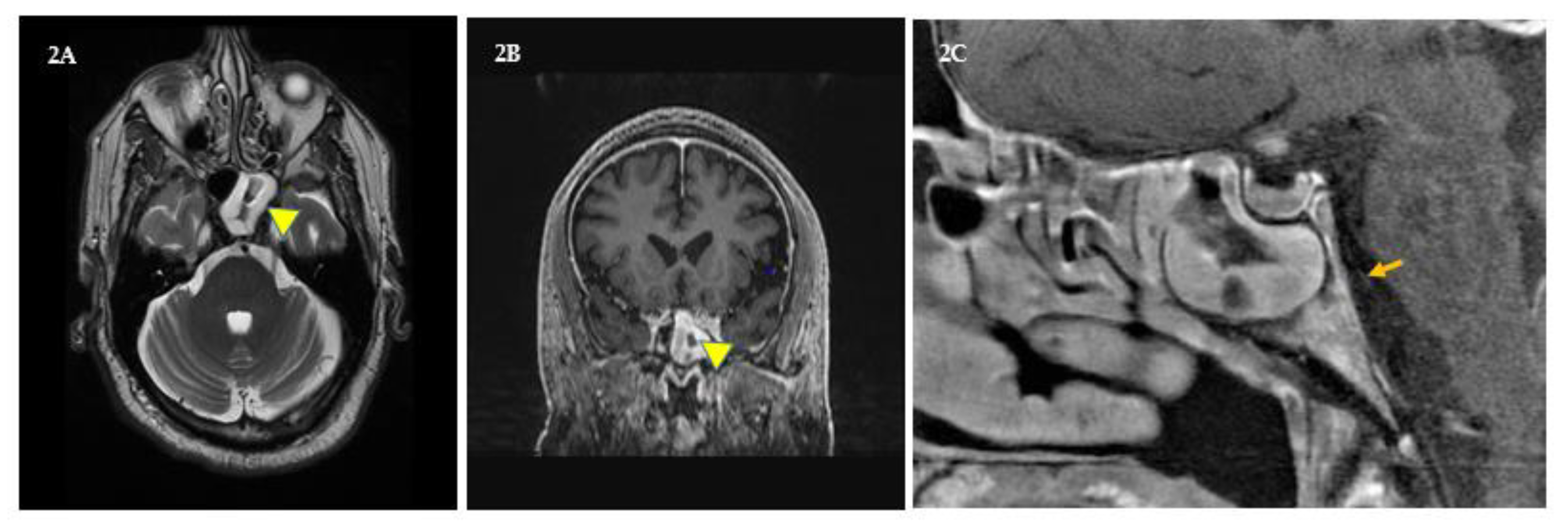 Brainsci 09 00281 g002 Brainsci 09 00281 g002