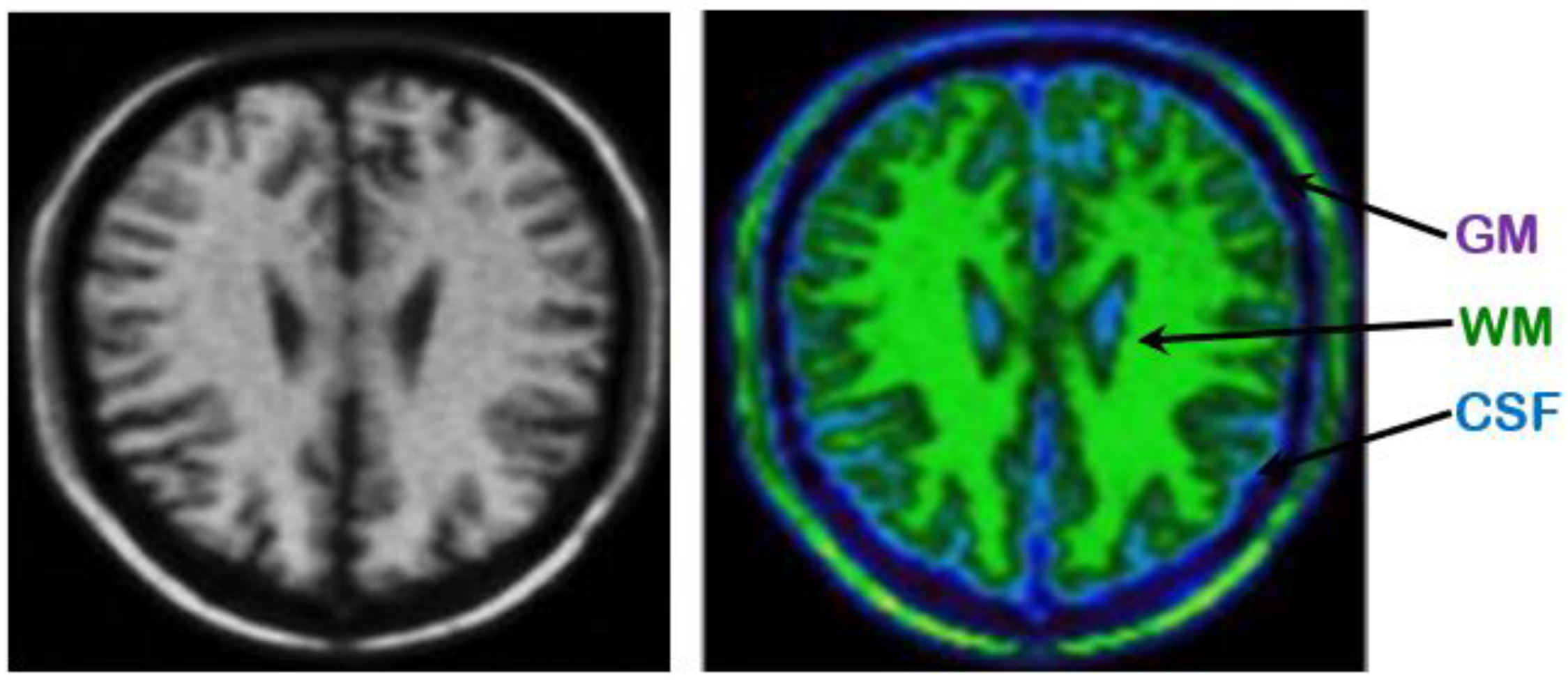 Brainsci 09 00289 g004 Brainsci 09 00289 g004