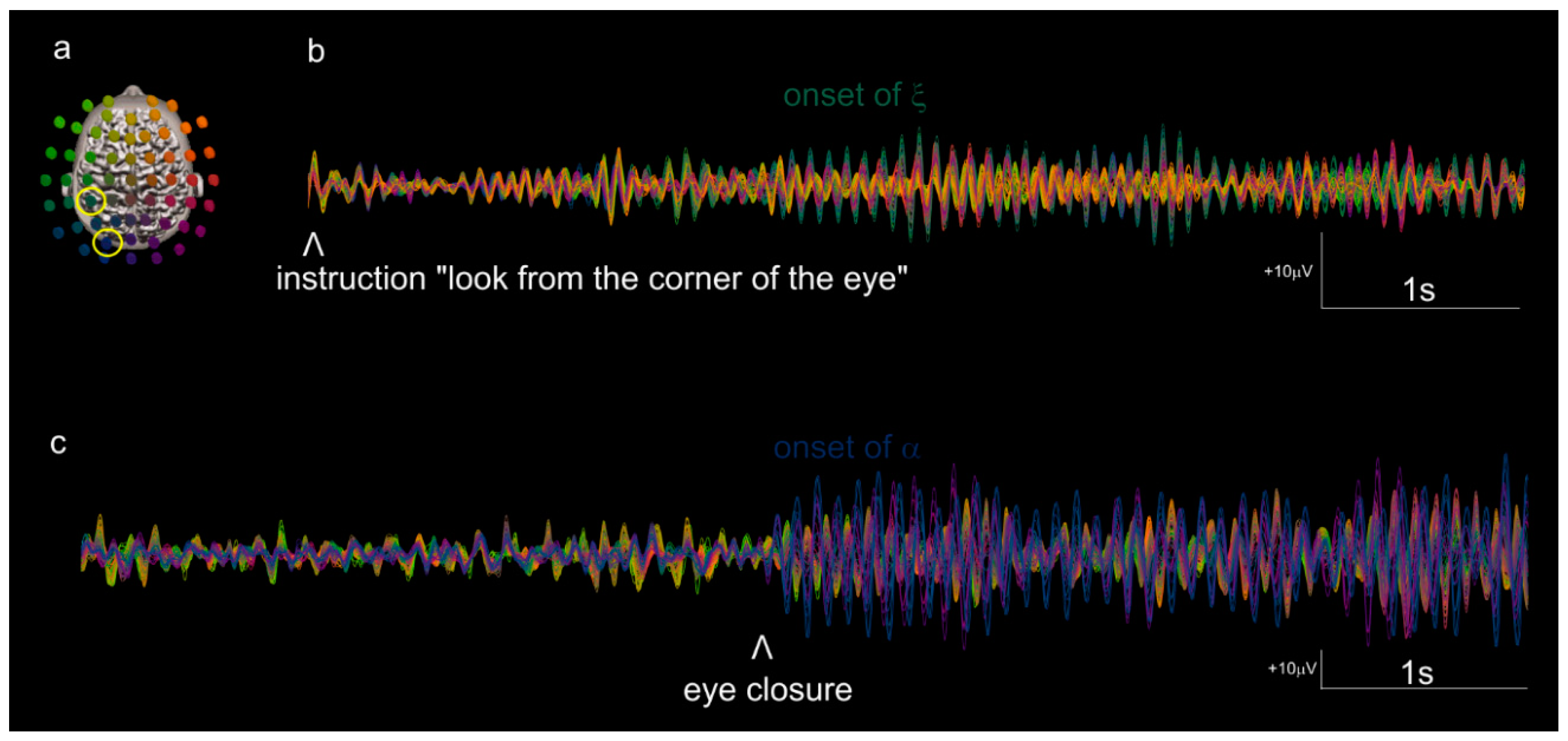 Brainsci 09 00307 g002