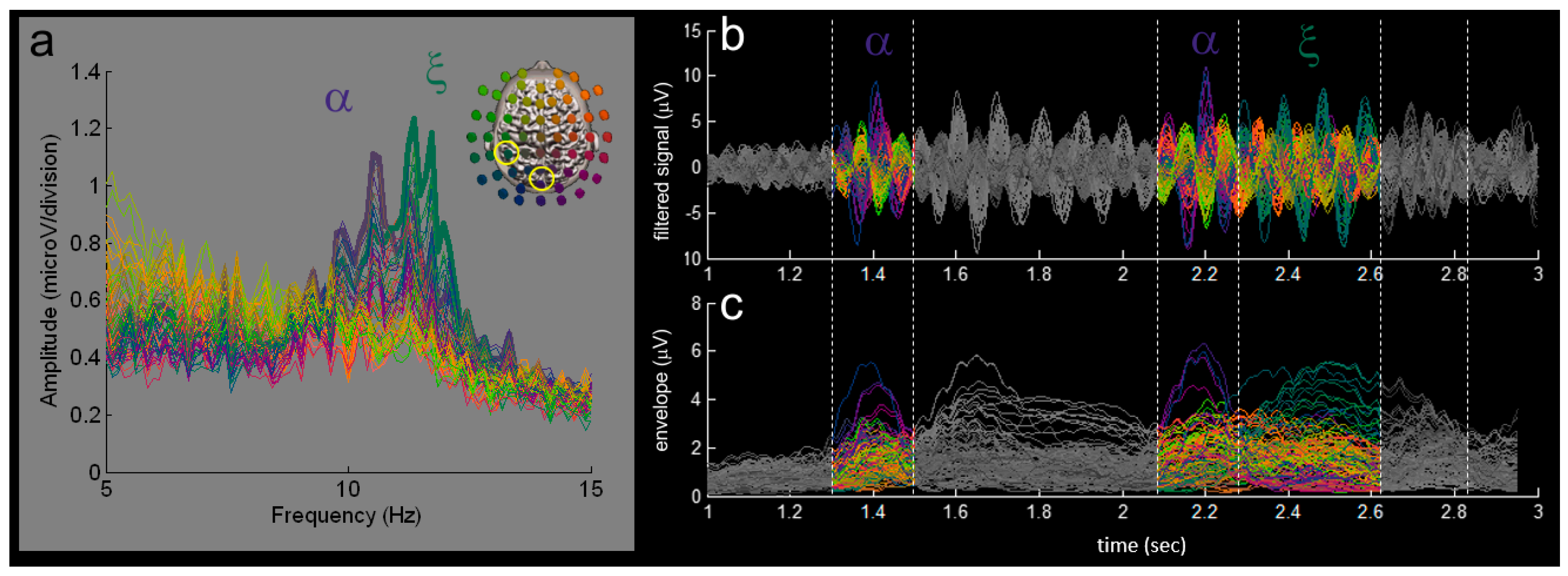 Brainsci 09 00307 g003