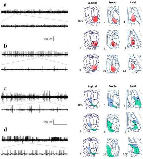 Brainsci 09 00312 g0a2