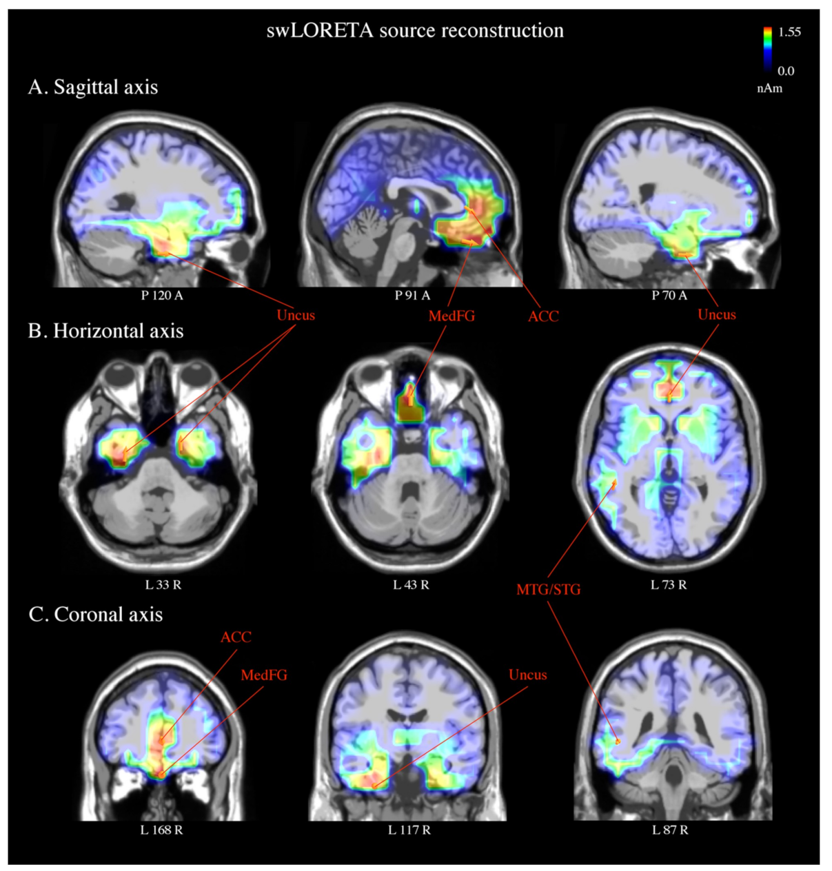 Brainsci 09 00315 g009 Brainsci 09 00315 g009