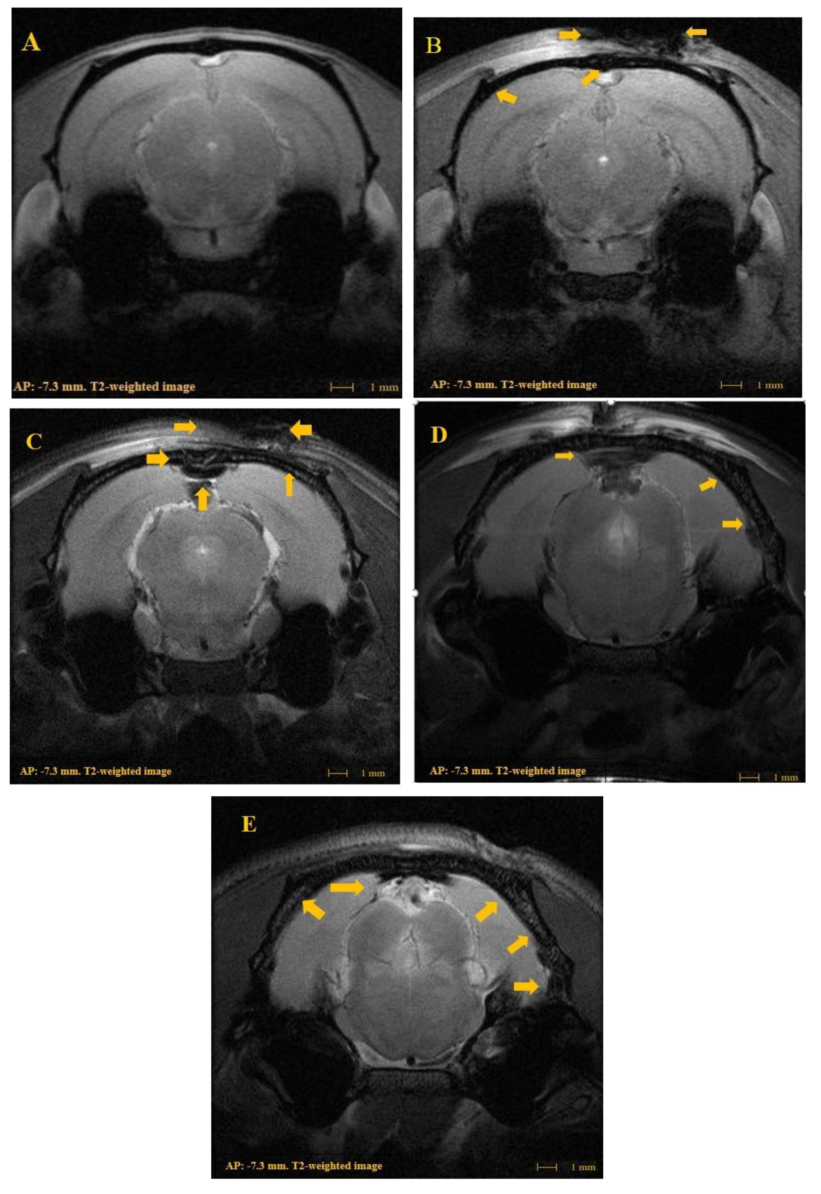 Brainsci 09 00325 g002 Brainsci 09 00325 g002