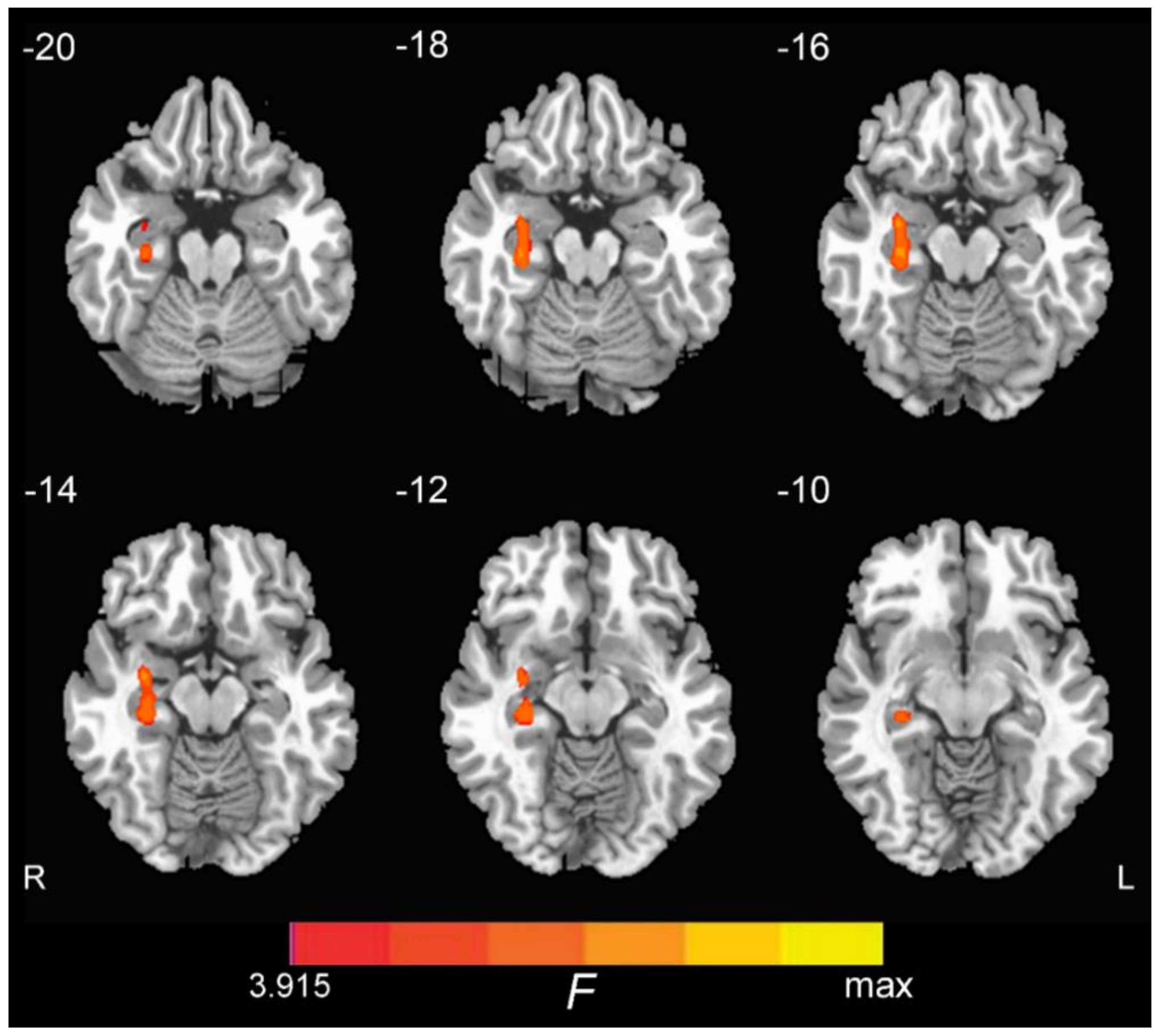 Brainsci 09 00338 g001 Brainsci 09 00338 g001