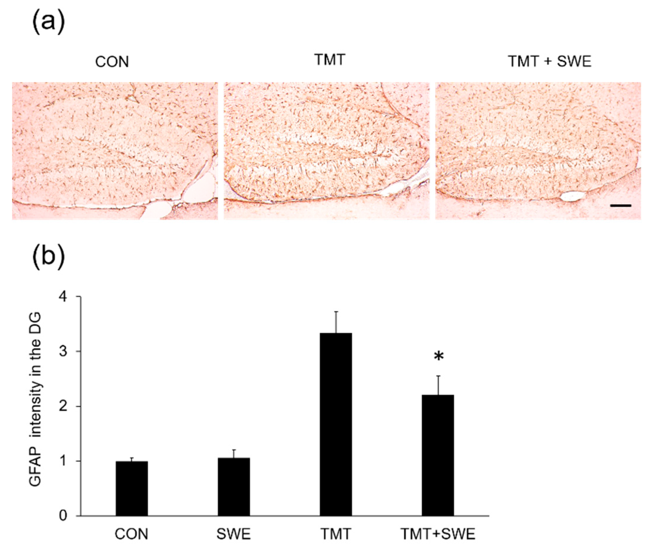 Brainsci 09 00369 g004
