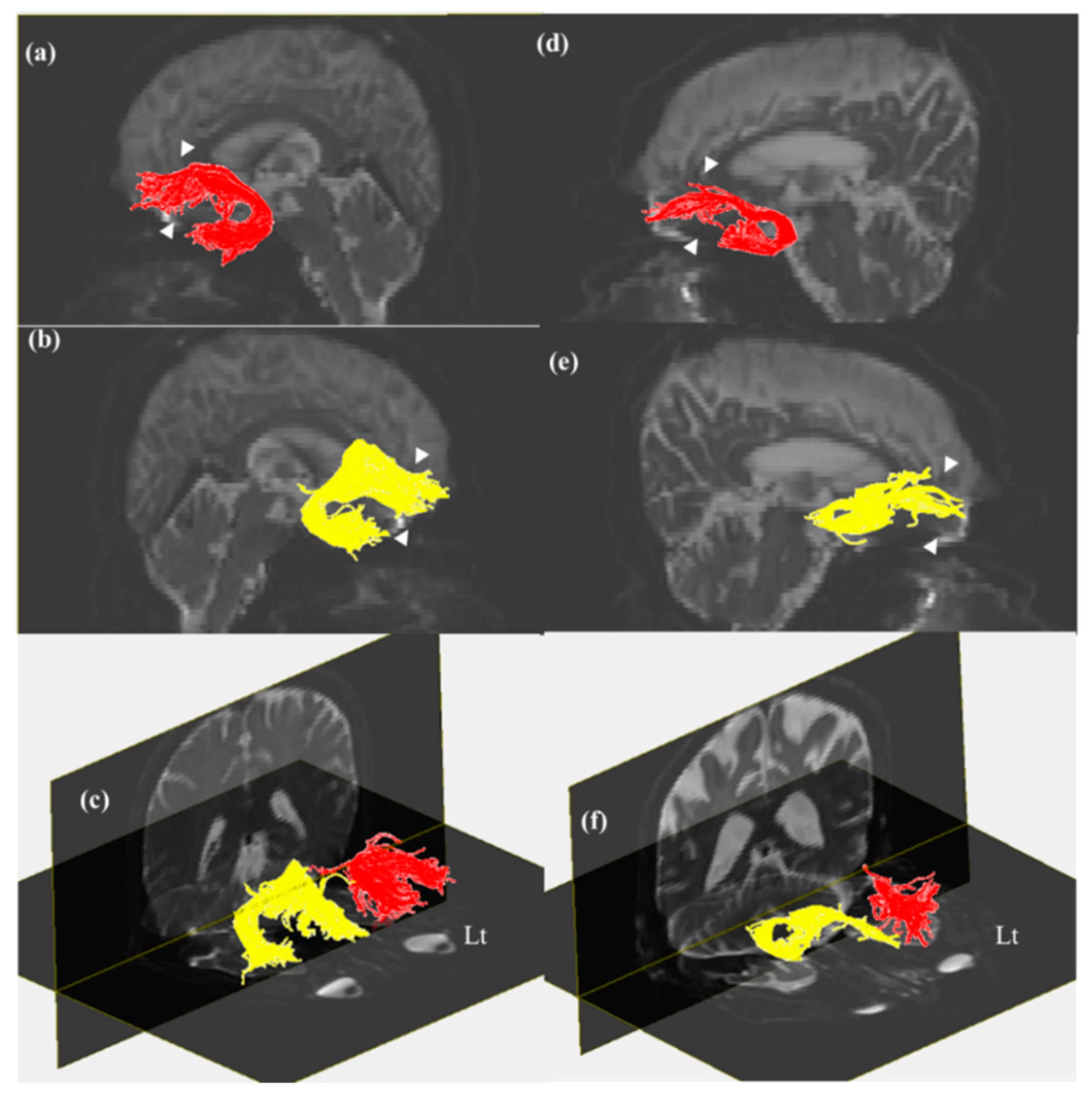 Brainsci 09 00377 g002