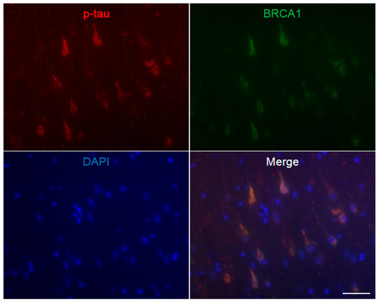 Brainsci 10 00007 g0a3