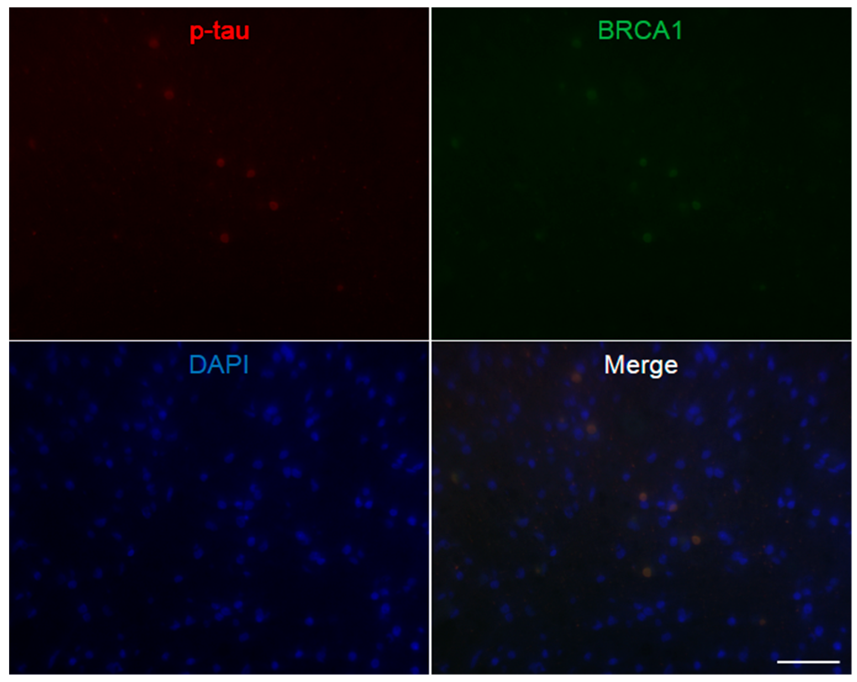 Brainsci 10 00007 g0a4