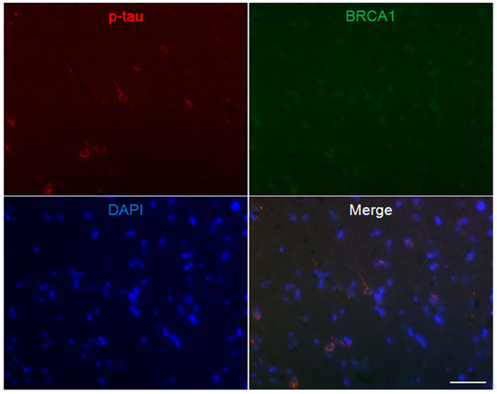 Brainsci 10 00007 g0a6