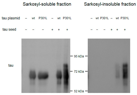 Brainsci 10 00007 g0a8