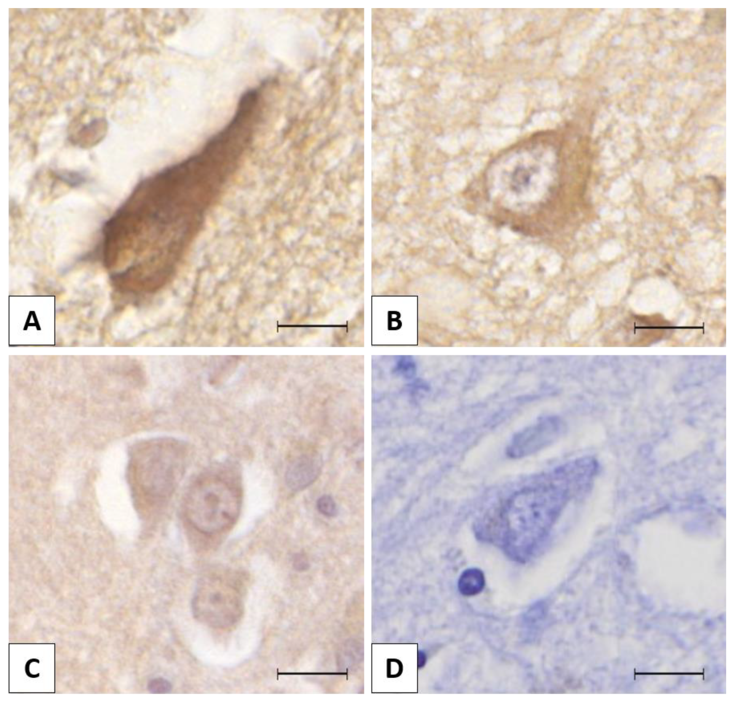 Brainsci 10 00068 g001 Brainsci 10 00068 g001