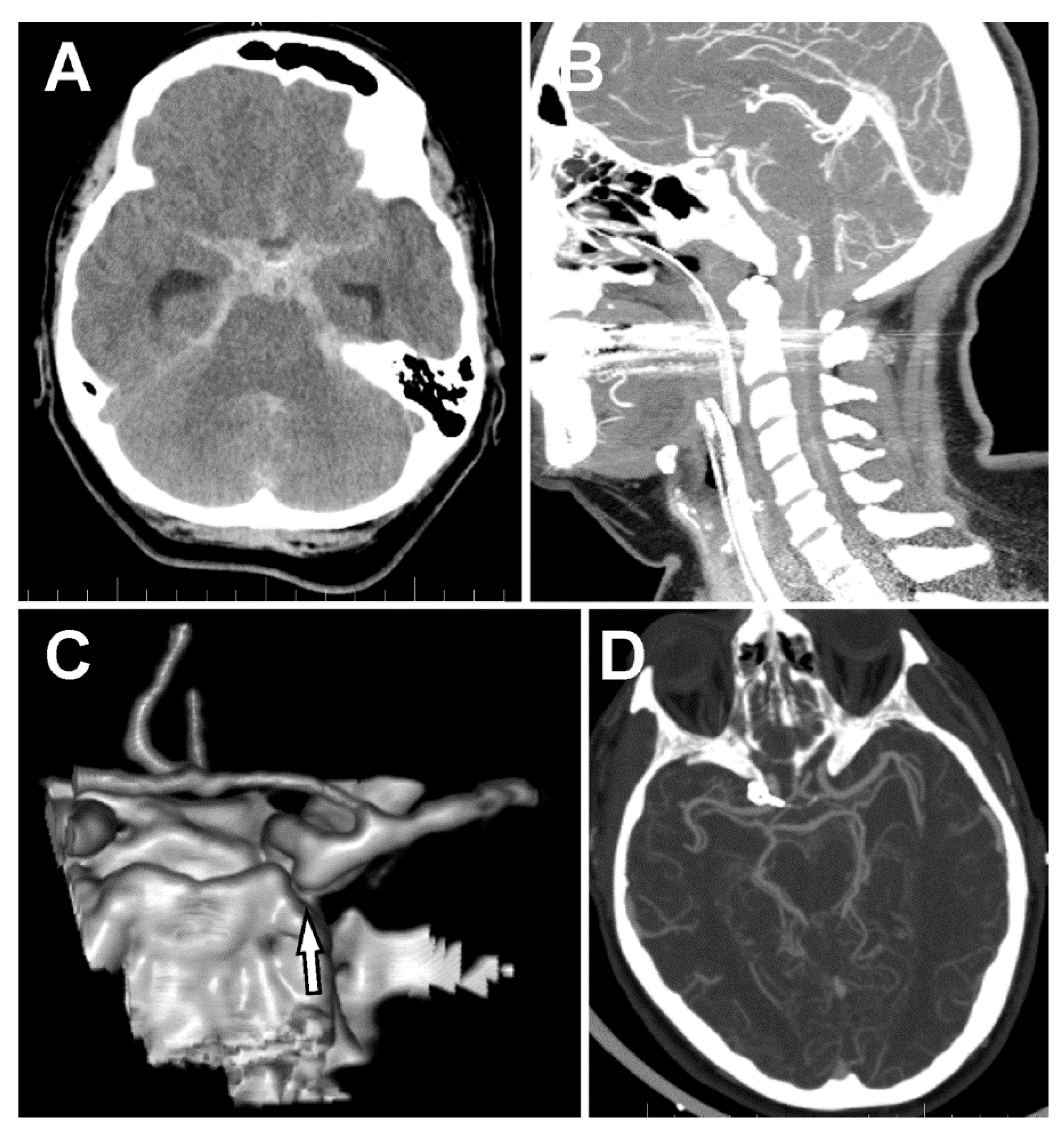 Brainsci 10 00070 g001