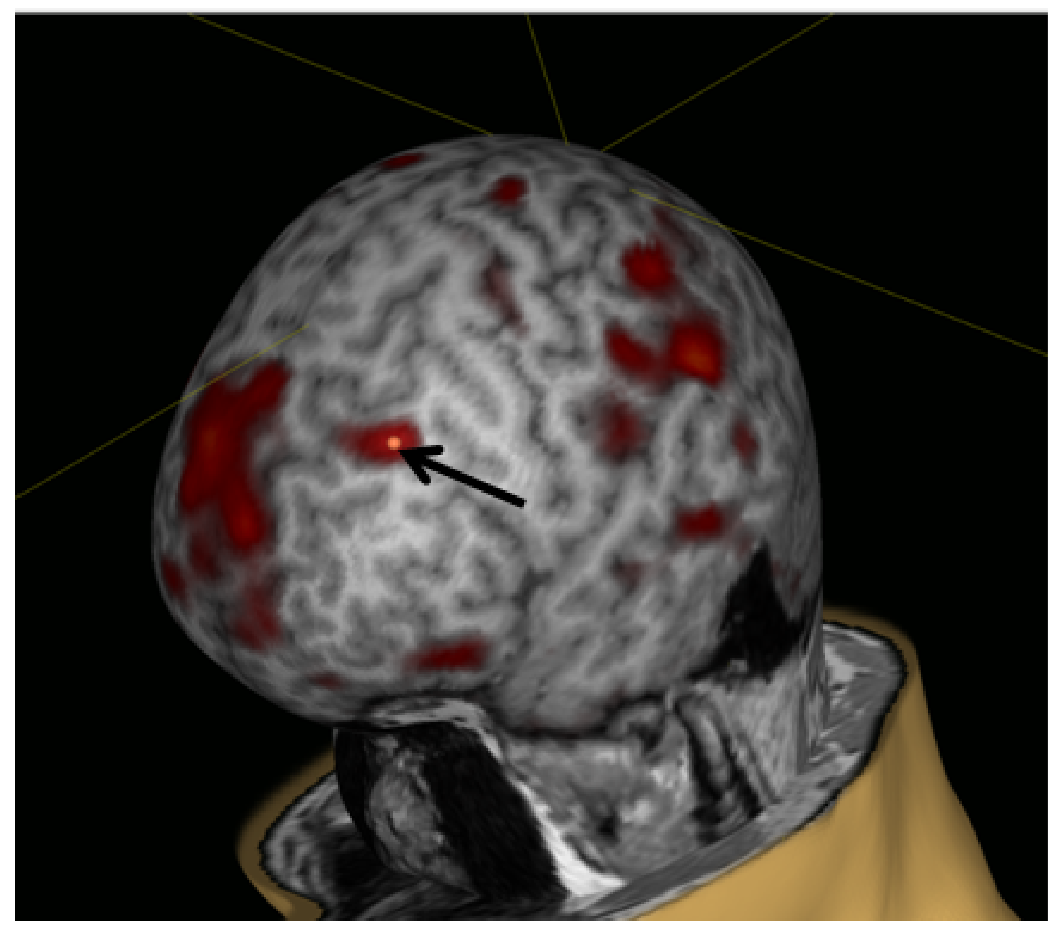 Brainsci 10 00083 g003 Brainsci 10 00083 g003